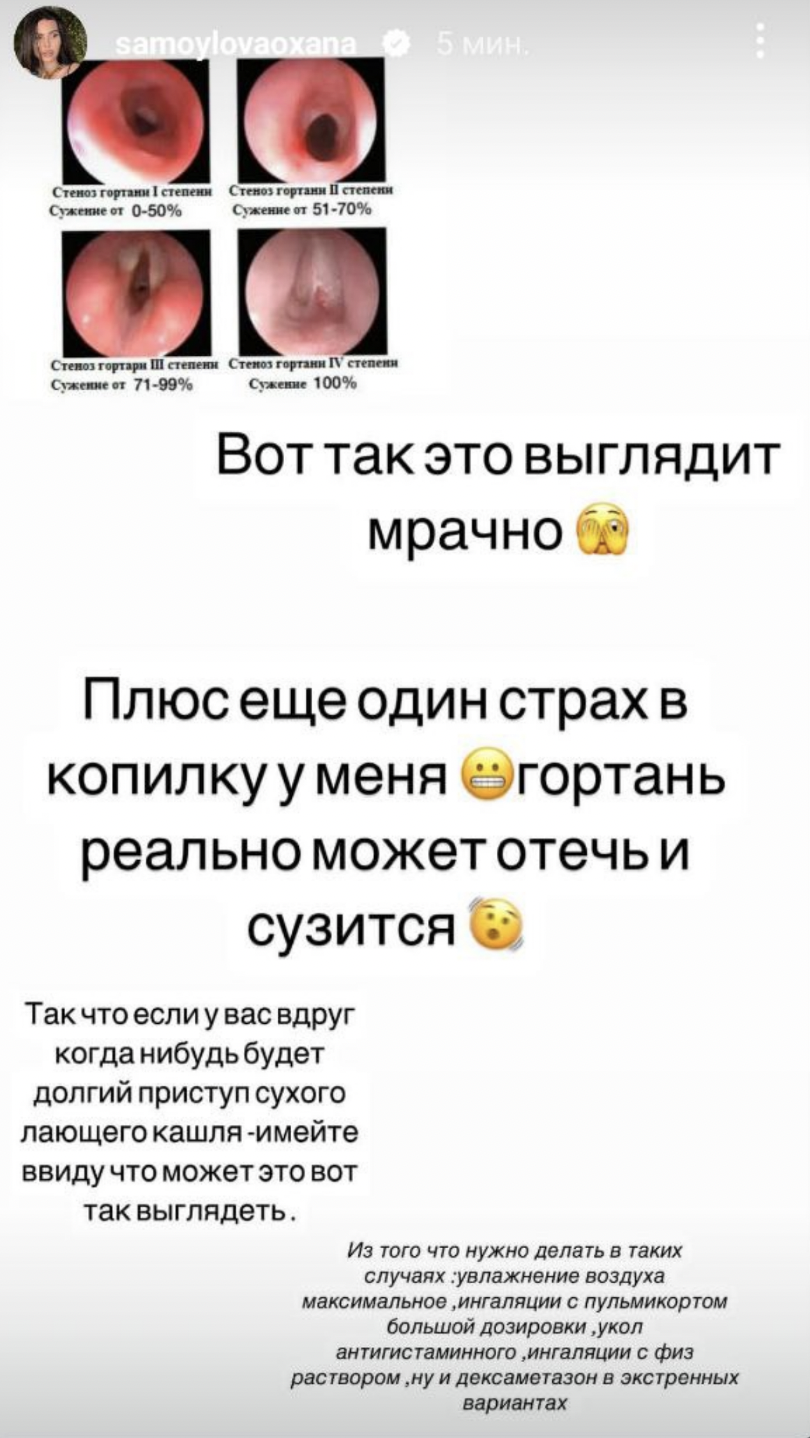 Скрин: Инстаграм* @samoylovaoxana