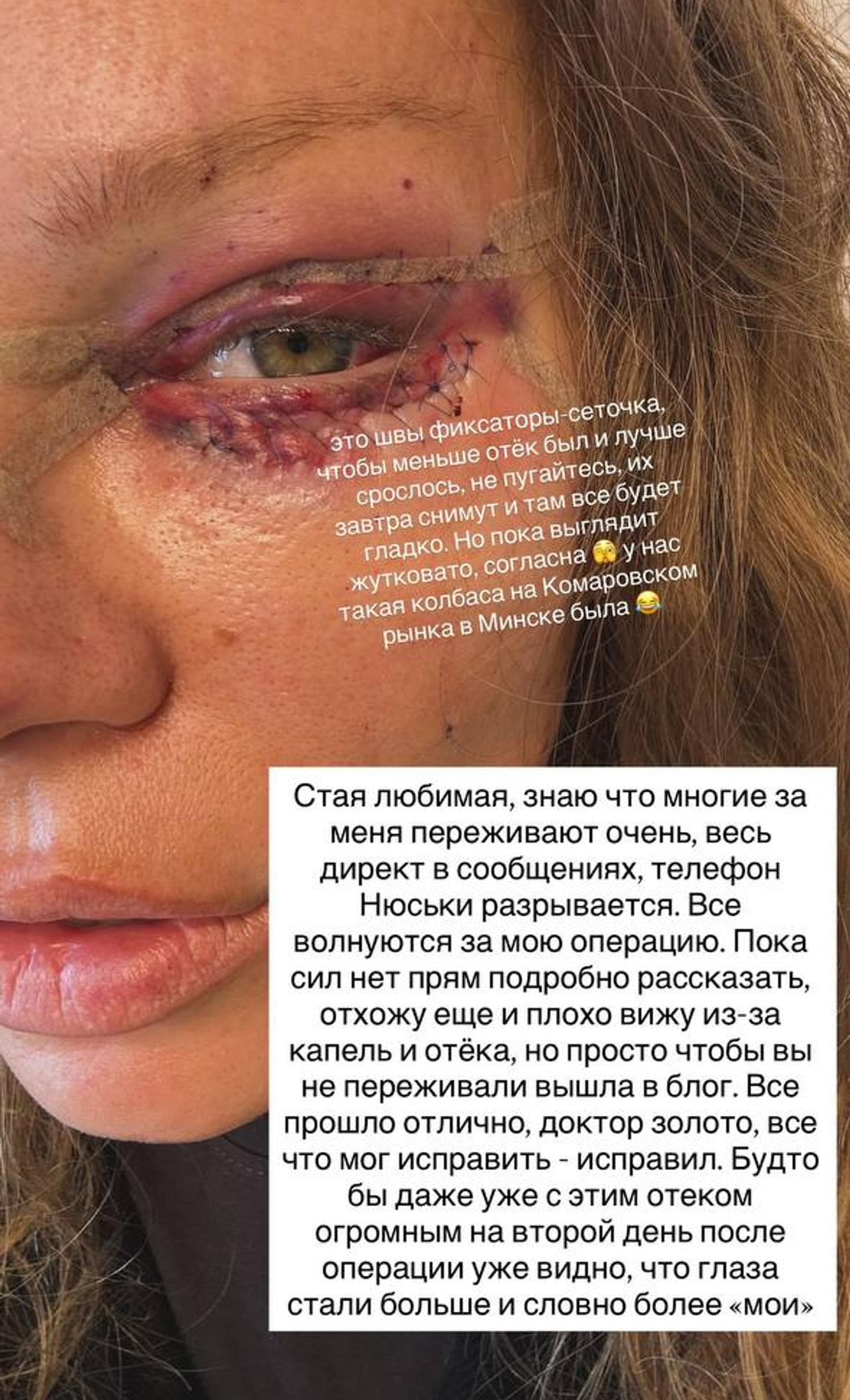 Рита Дакота. Фото: Telegram @ritadakotatelega