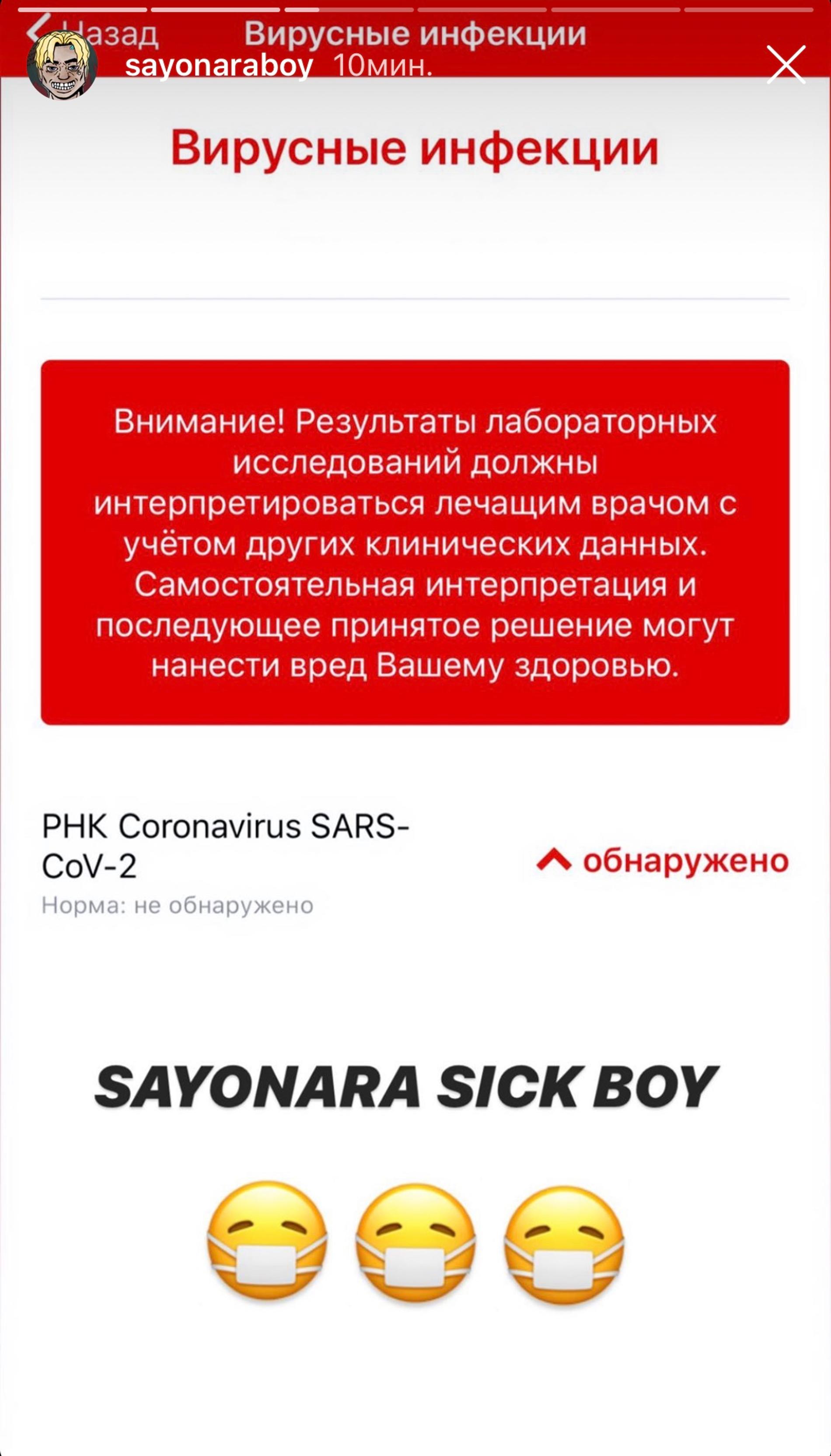 Инстаграм артиста