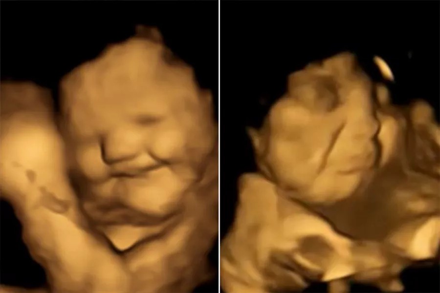 Новое исследование: какие продукты вызывают у детей в утробе матери улыбку