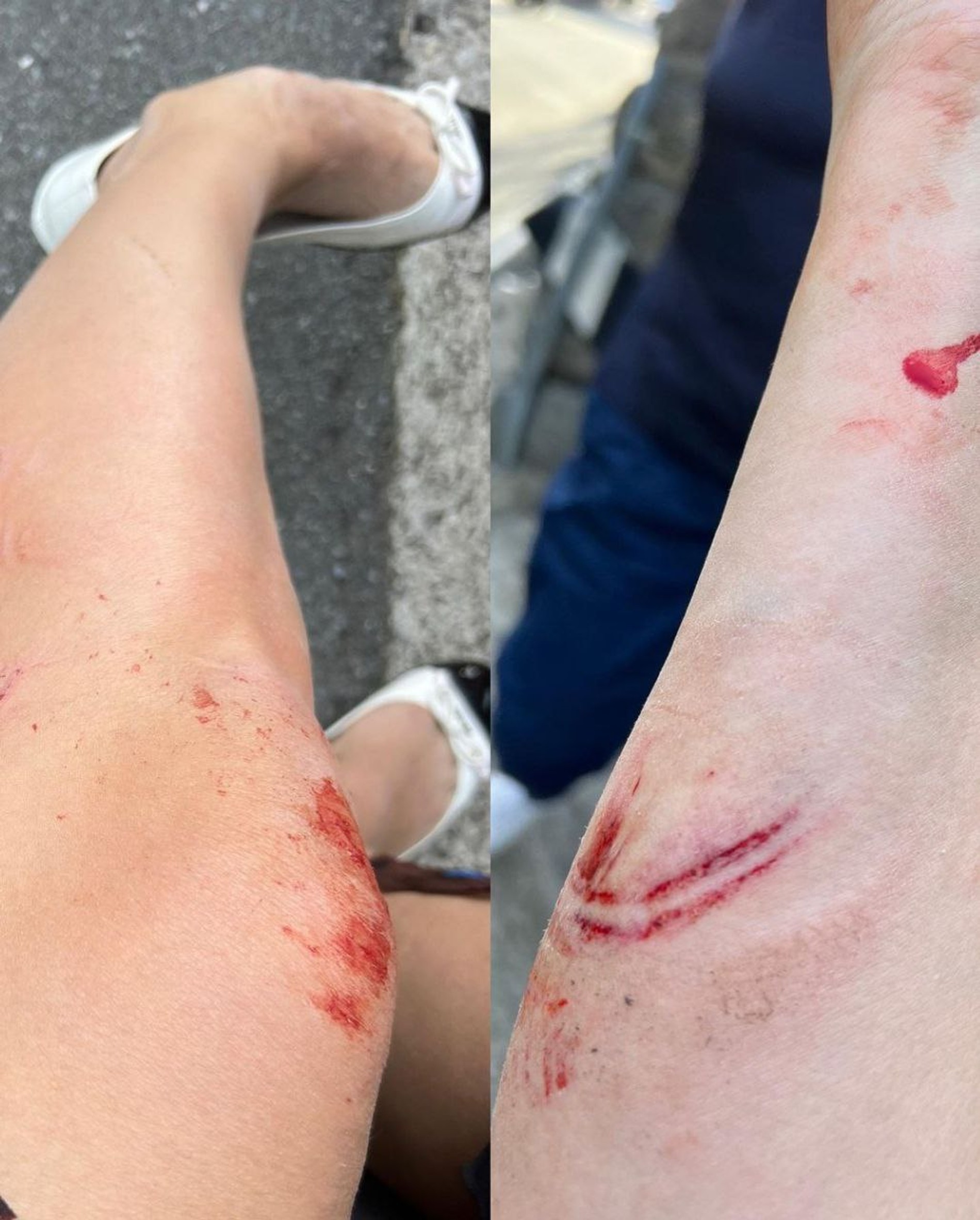 Фото с места аварии с участием Лены Лениной
Фото: Инстаграм (запрещен в РФ) Лены Лениной