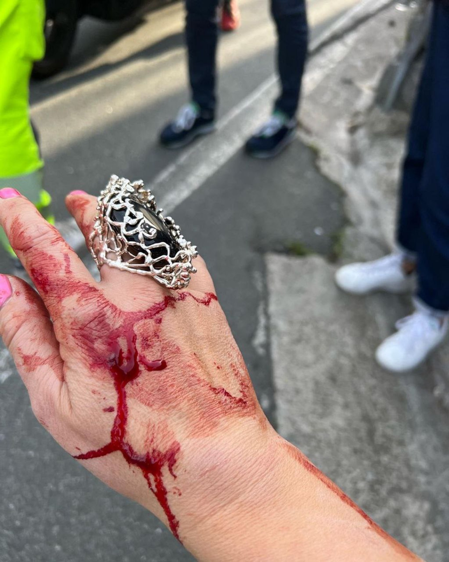 Фото с места аварии с участием Лены Лениной
Фото: Инстаграм (запрещен в РФ) Лены Лениной