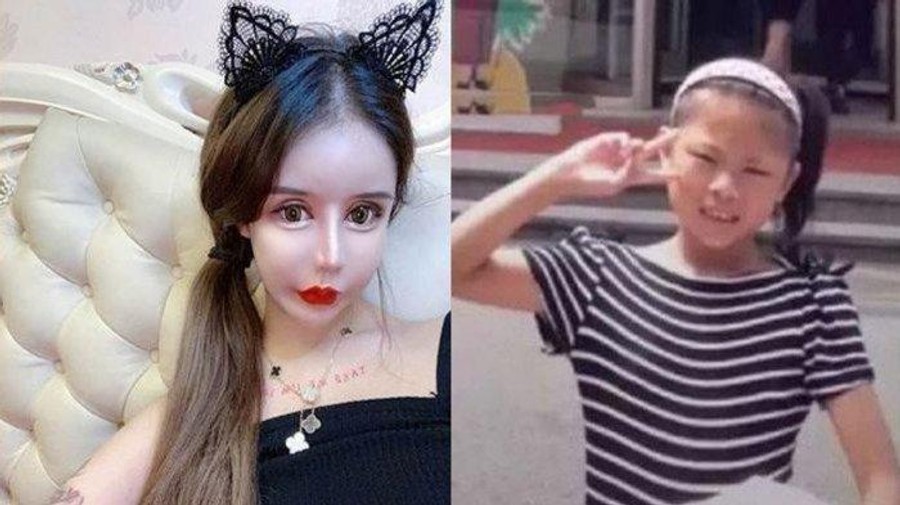 Чжоу Чуна до и после пластических операций
Фото: Sina Weibo