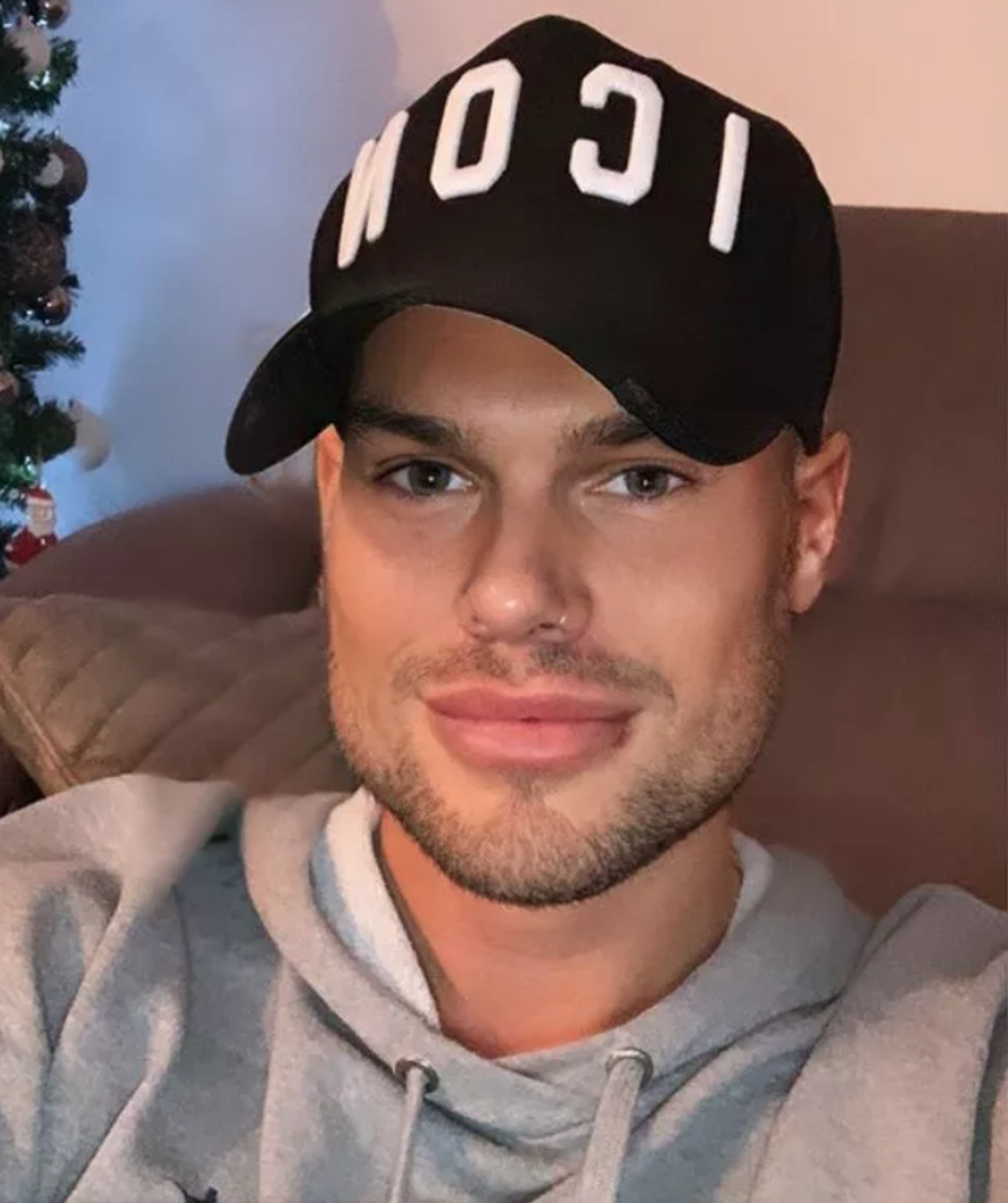 Дейл Сент-Каллен после пластических операций
Фото: Инстаграм (запрещен в РФ)