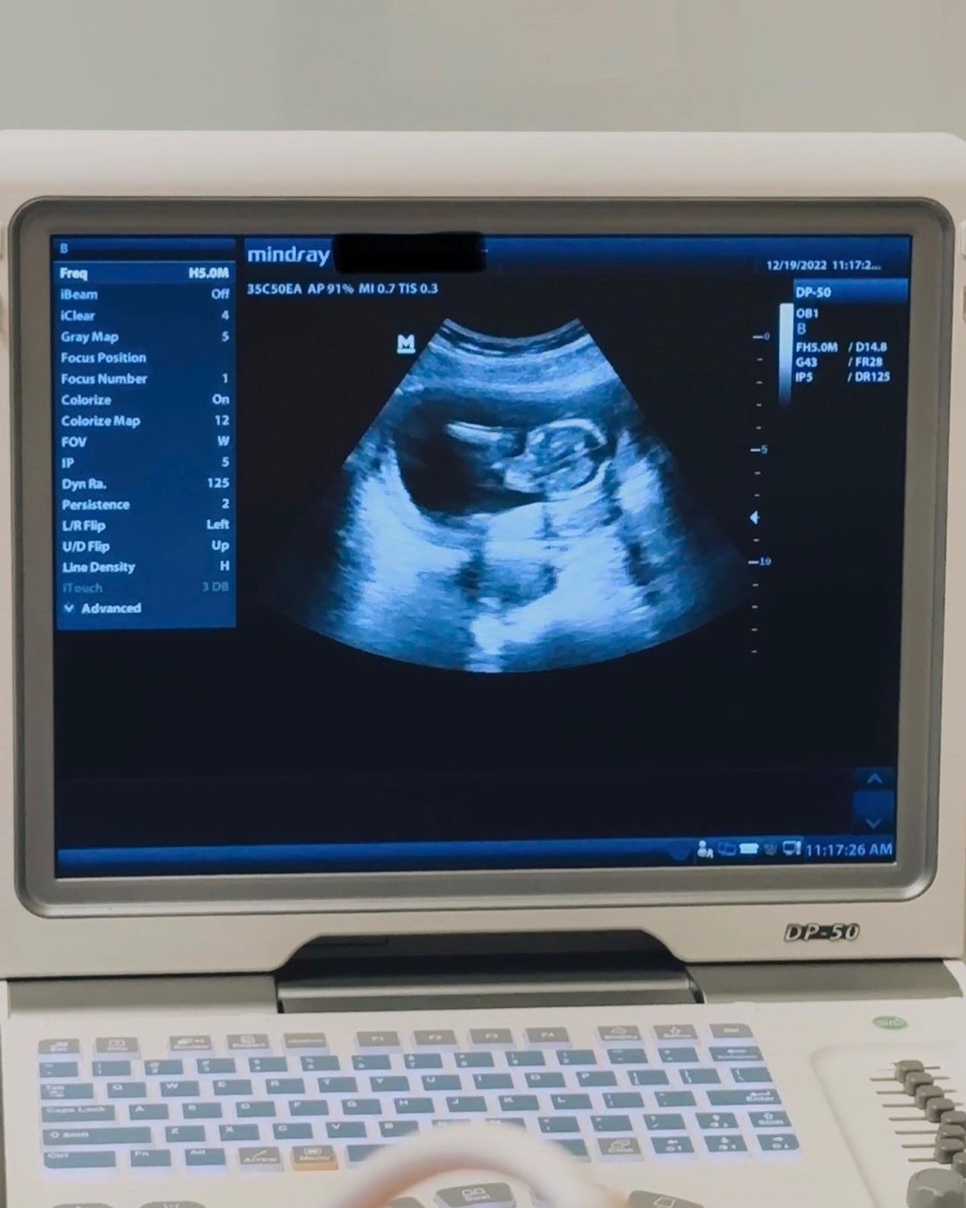 Источник: Инстаграм (запрещен в РФ) Айрленд Болдуин