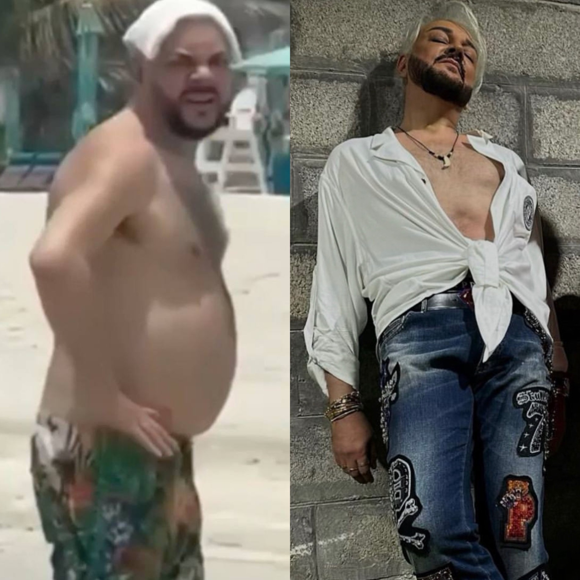 Филипп Киркоров до комплексного преображения и после
Фото: соцсети / Инстаграм (запрещен в РФ) Тимура Хайдарова