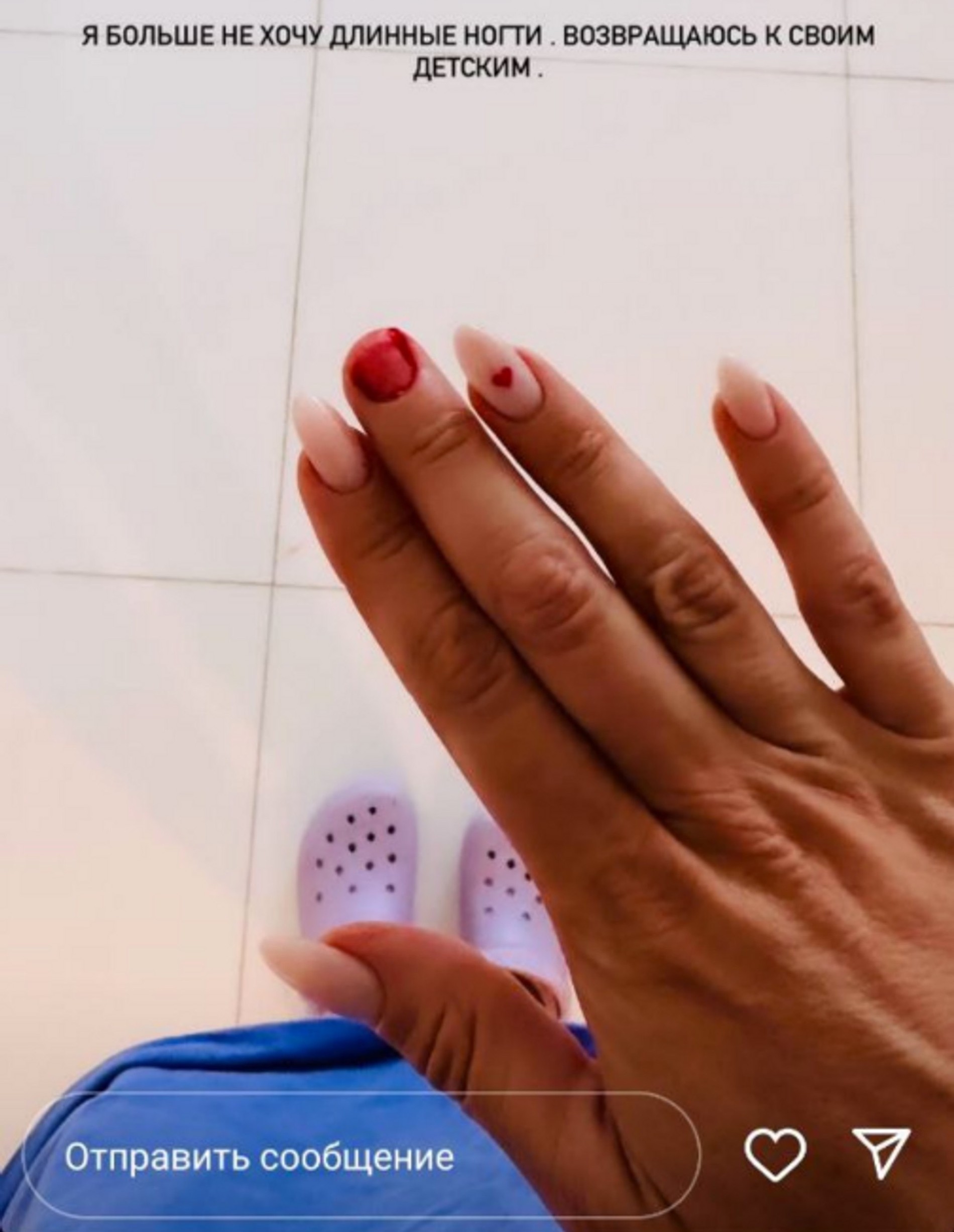 Анна Седокова получила травму, разнимая дерущихся собак
Фото: Инстаграм (запрещен в РФ) Анны Седоковой