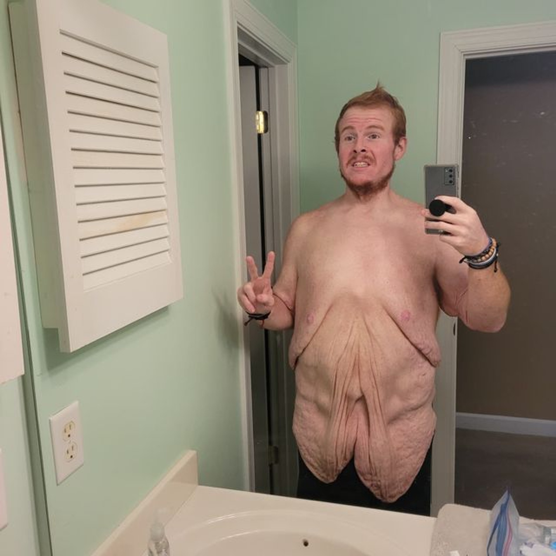 Кейси Кинг после похудения
Фото: Инстаграм (запрещен в РФ) / @_caseyking_