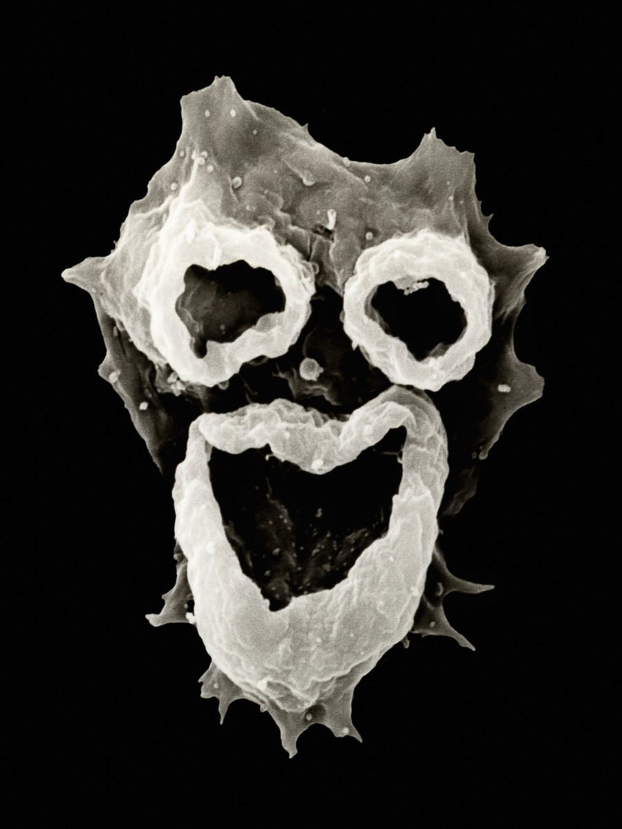 Мужчина промыл нос водой из-под крана и умер от поедающей мозг амебы