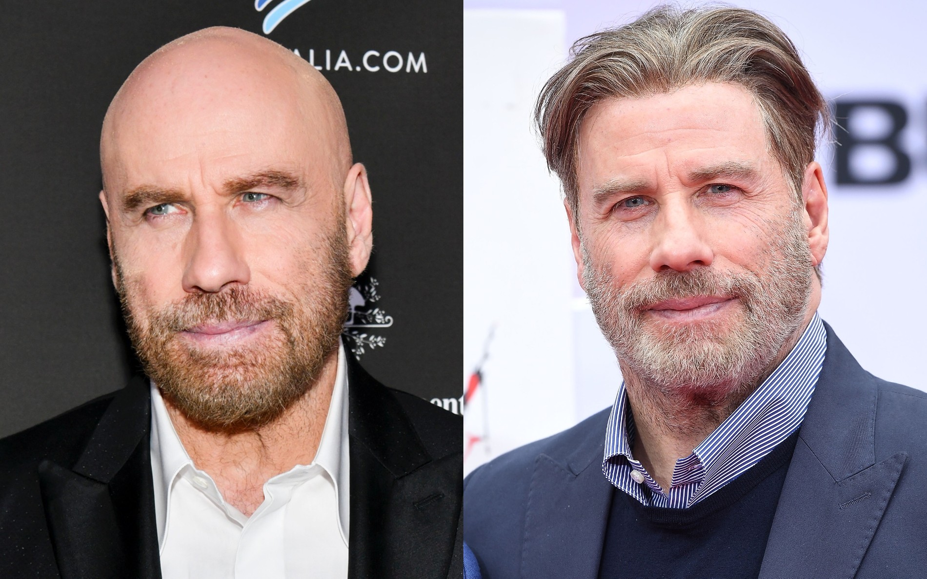 Фото: Getty Images