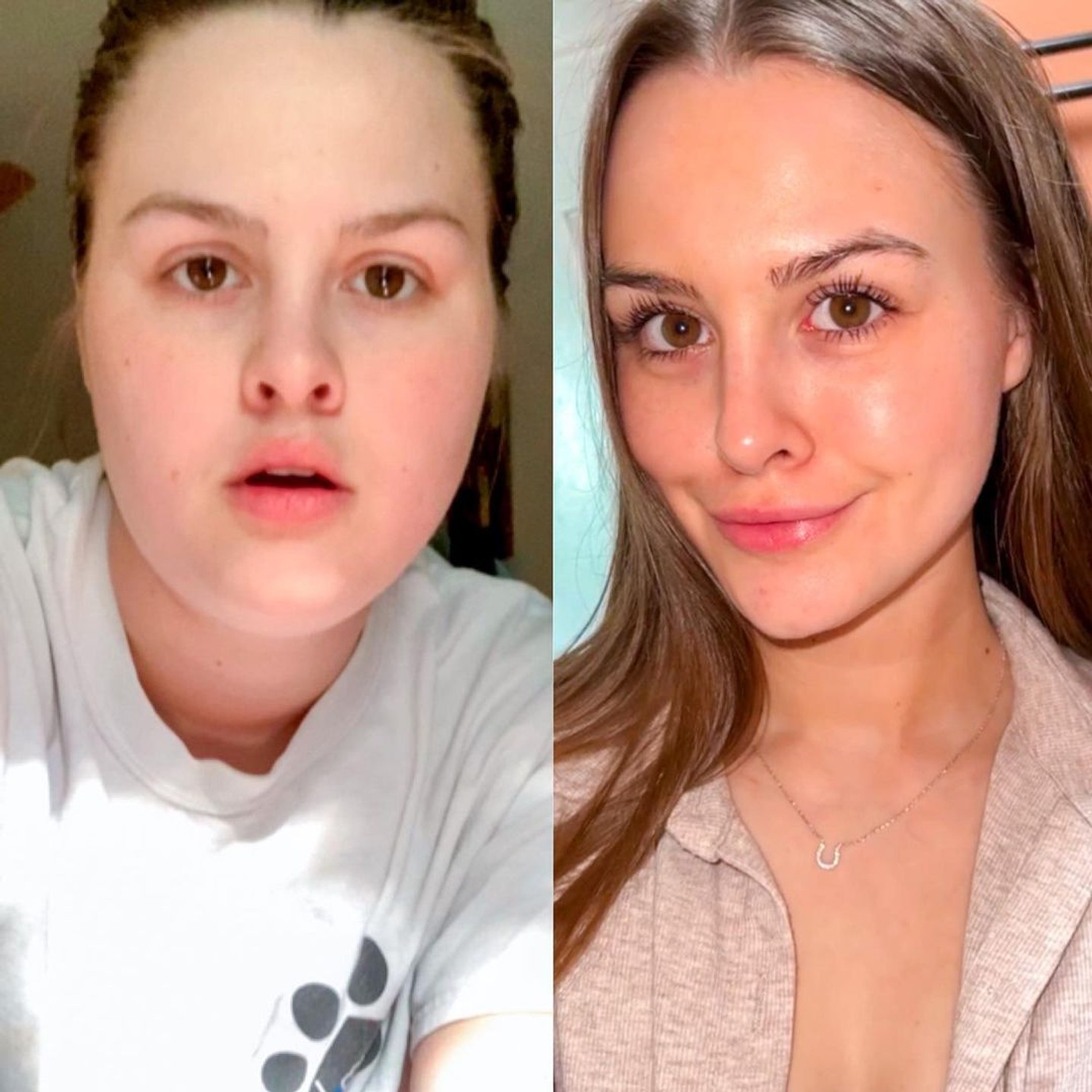 Мэдисон до и после похудения
Фото: Инстаграм* @madisonoking