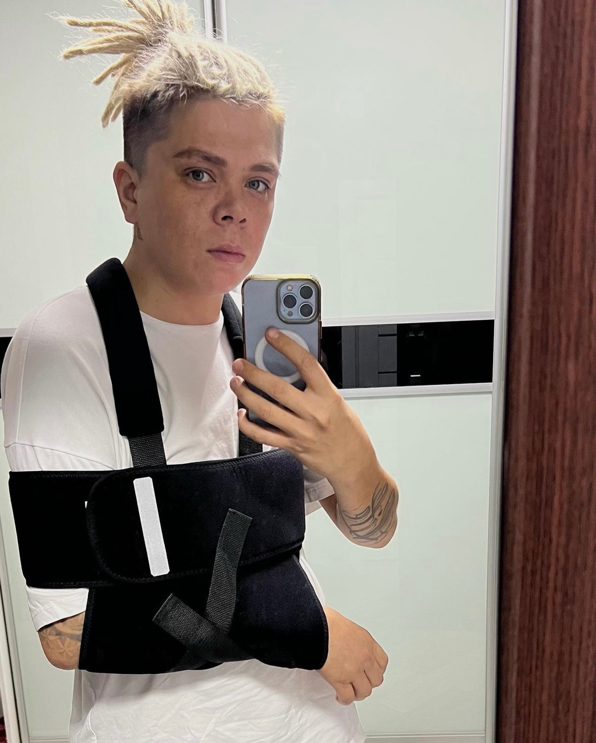 Элвин Грей после аварии
Фото: Инстаграм (запрещен в РФ) @elvin_grey_music