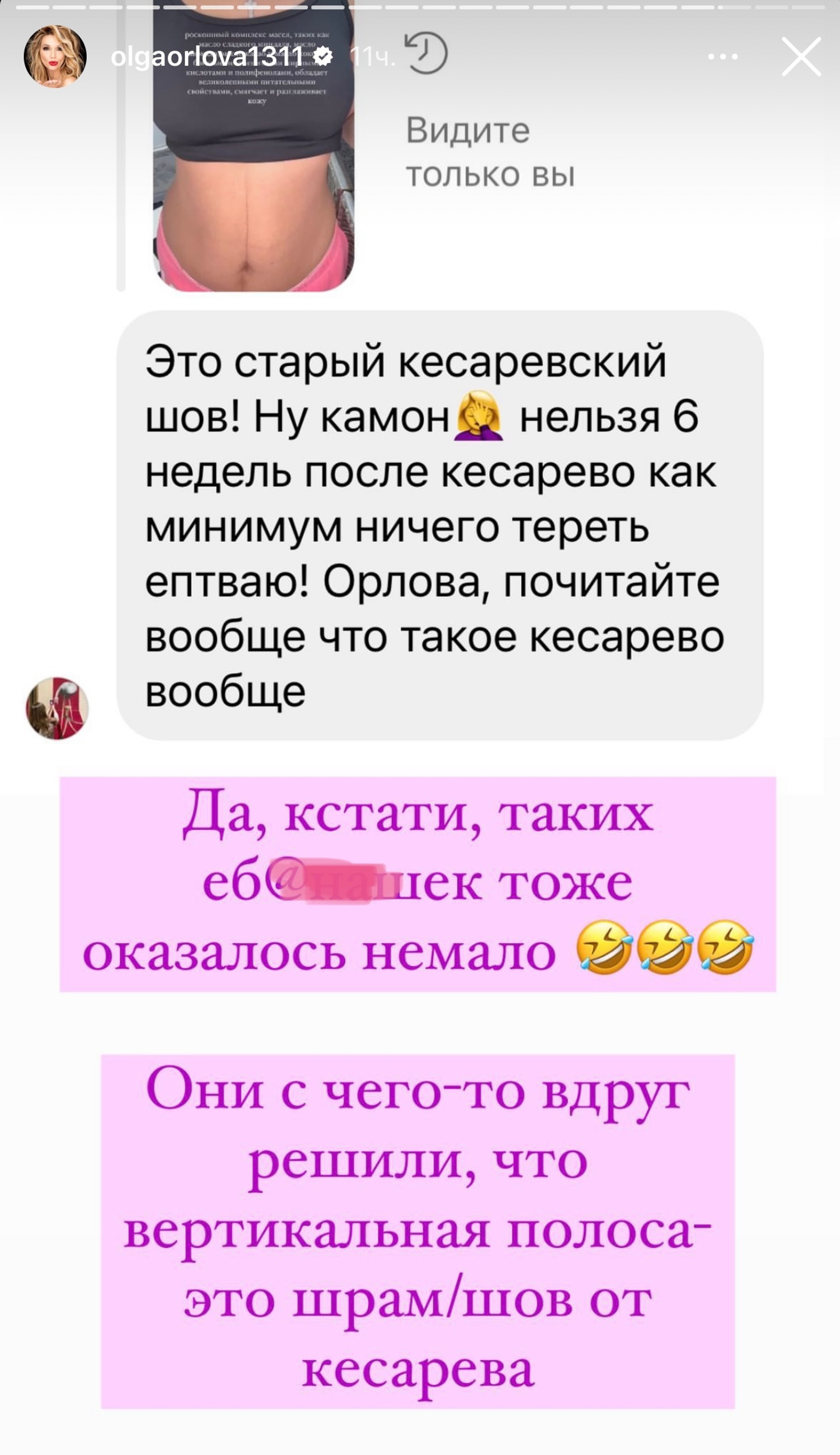 Ответ Ольги Орловой подписчикам, обвиняющим ее во лжи
Фото: Инстаграм*