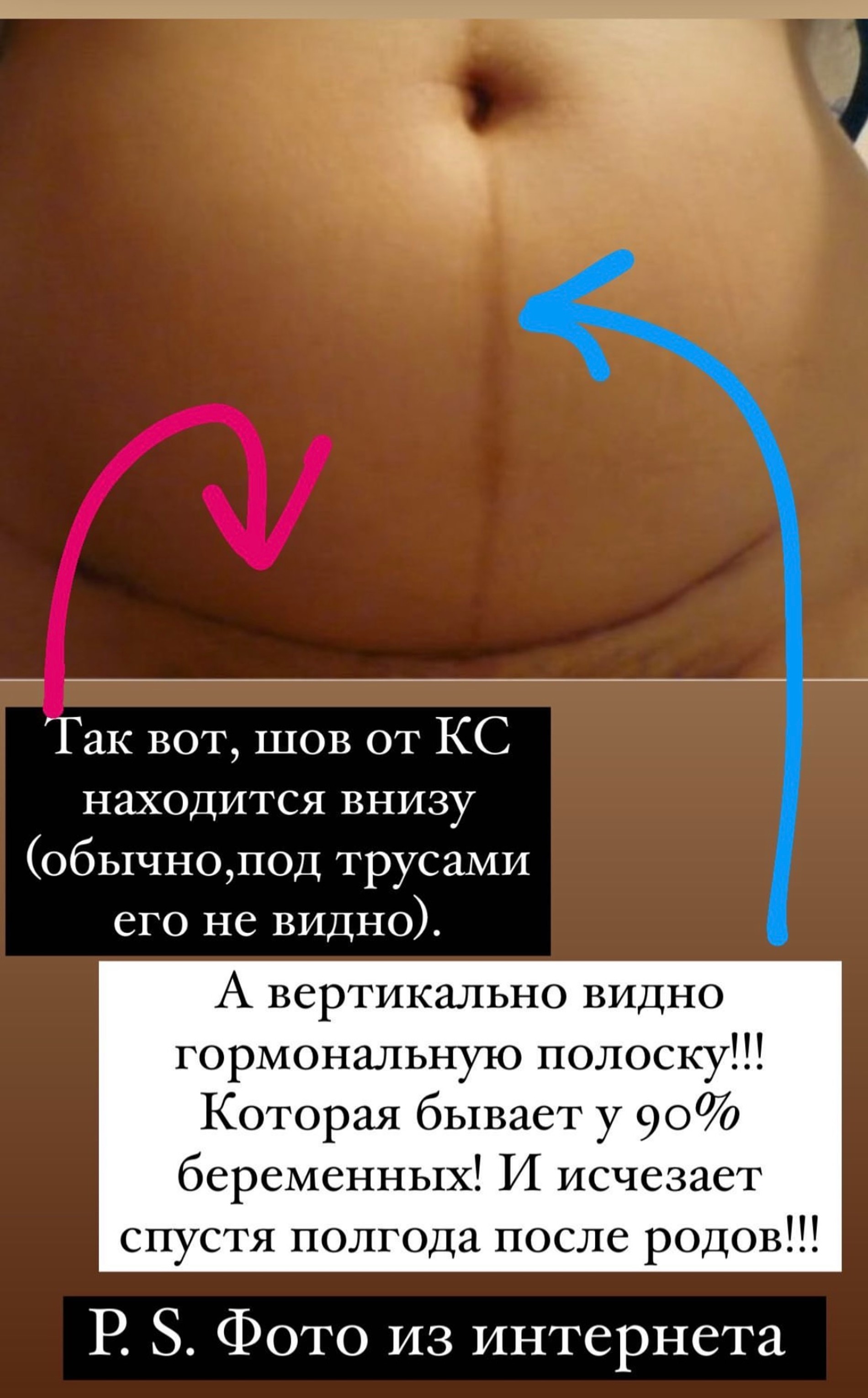 Ответ Ольги Орловой подписчикам, обвиняющим ее во лжи
Фото: Инстаграм*