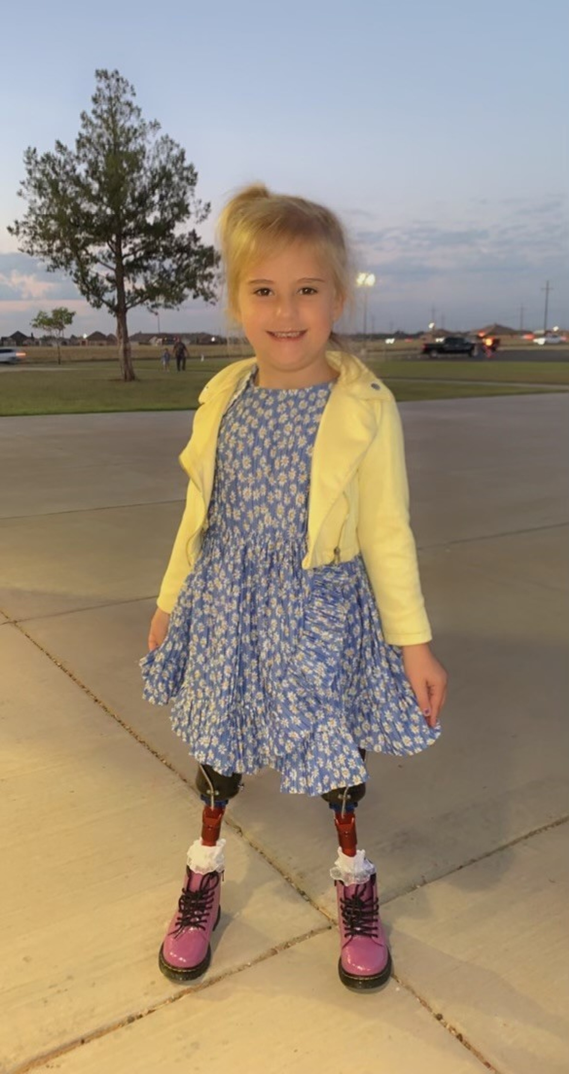 Подросшая Блэр после операции по разделению ног
Фото: Facebook (запрещен в РФ)