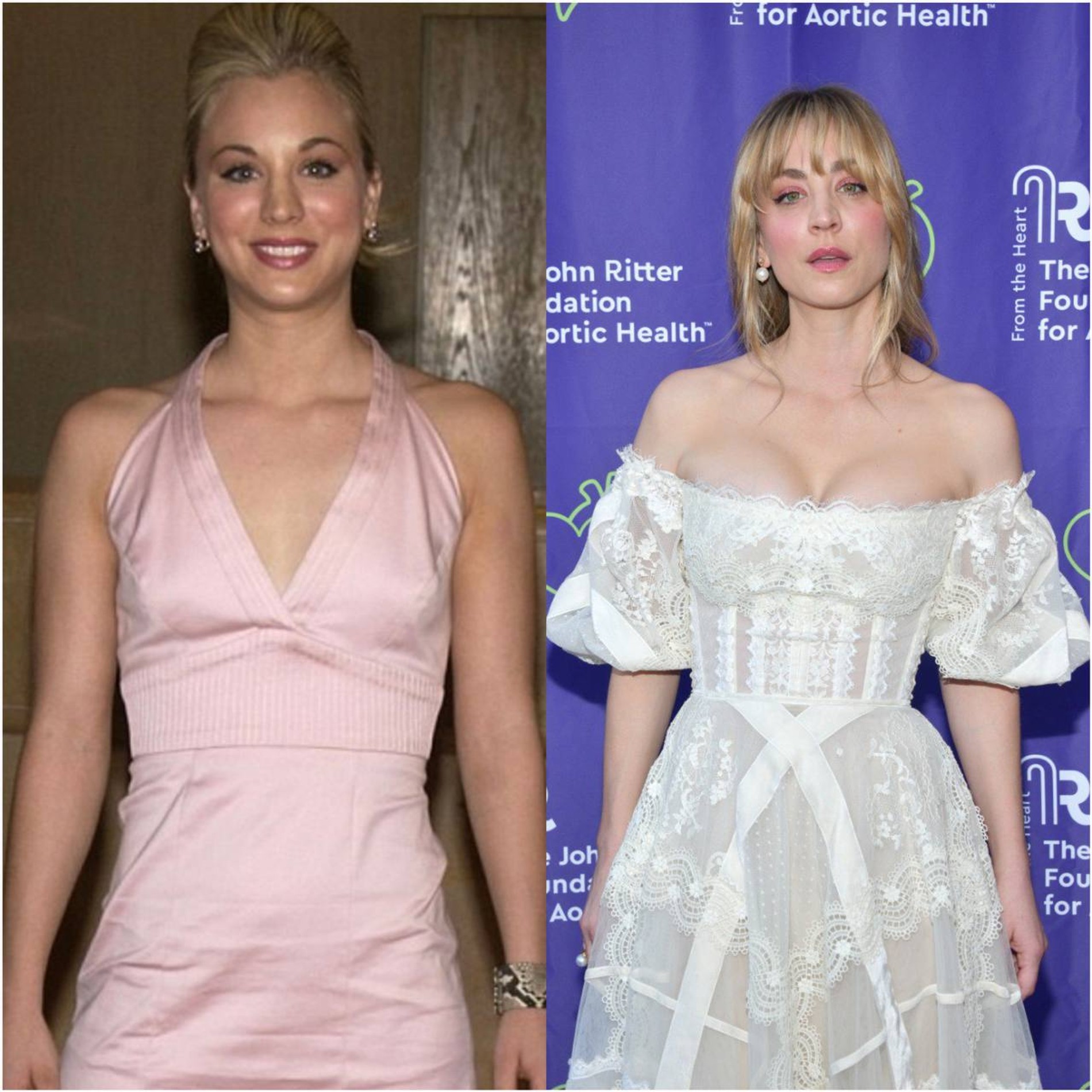 Слева — Кейли Куоко в 2003 году, справа — Кейли Куоко в 2022 году. Фото: Daily Mail, Getty Images