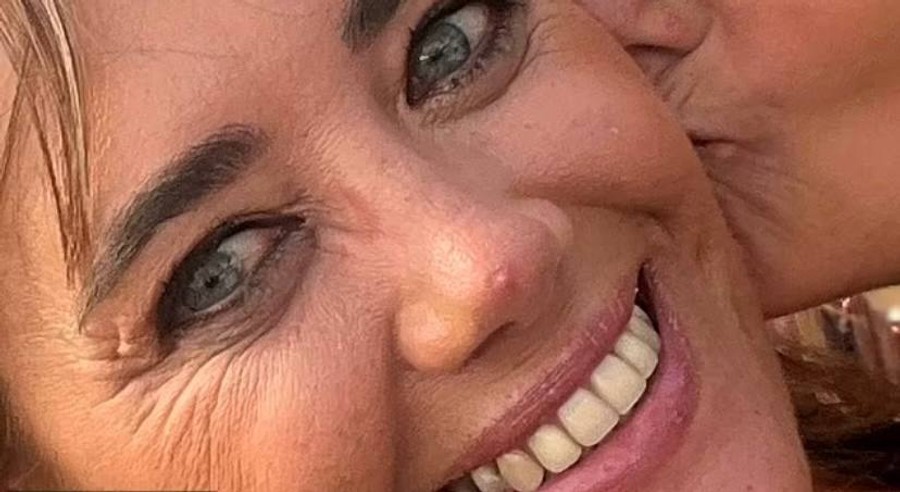 Мишель Дэвис с тем самым воспалением на носу
Фото: Daily Mail