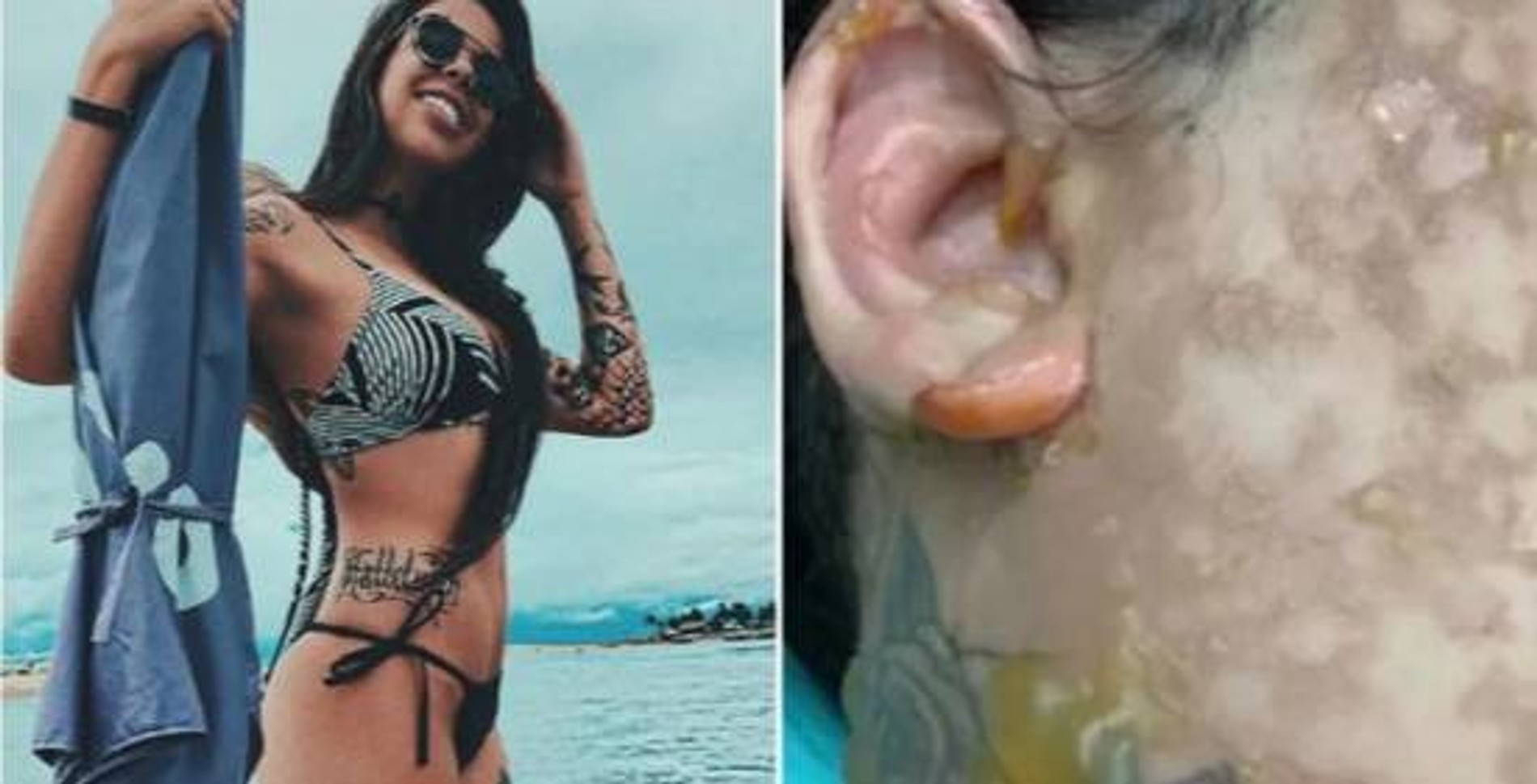 Джулиана до несчастного случая и фото ее ожогов
Фото: au.news.yahoo.com