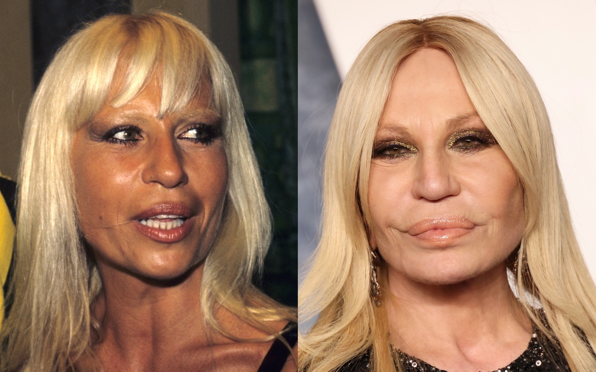 1993/2023
Фото: Getty Images