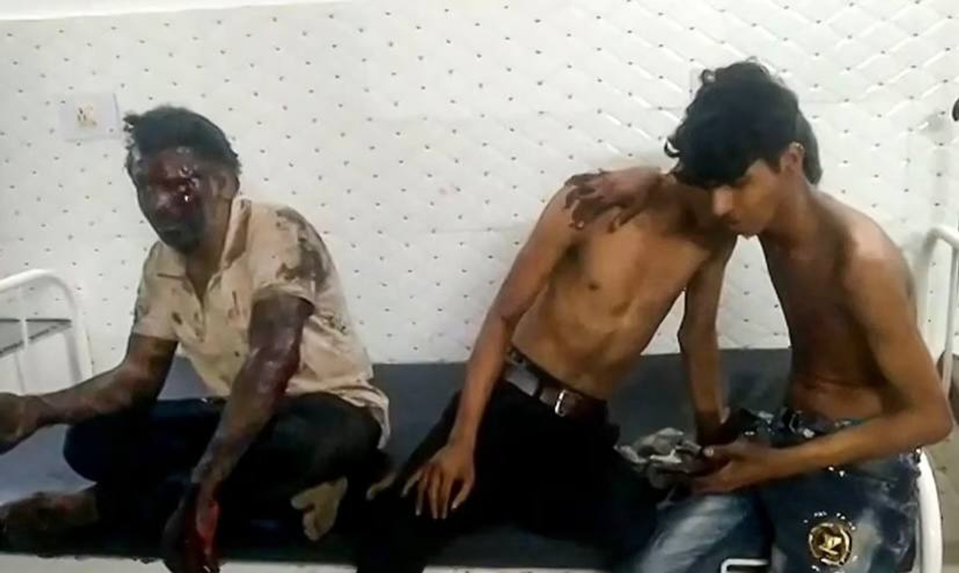 Пострадавшие в больнице
Фото: Daily Mail