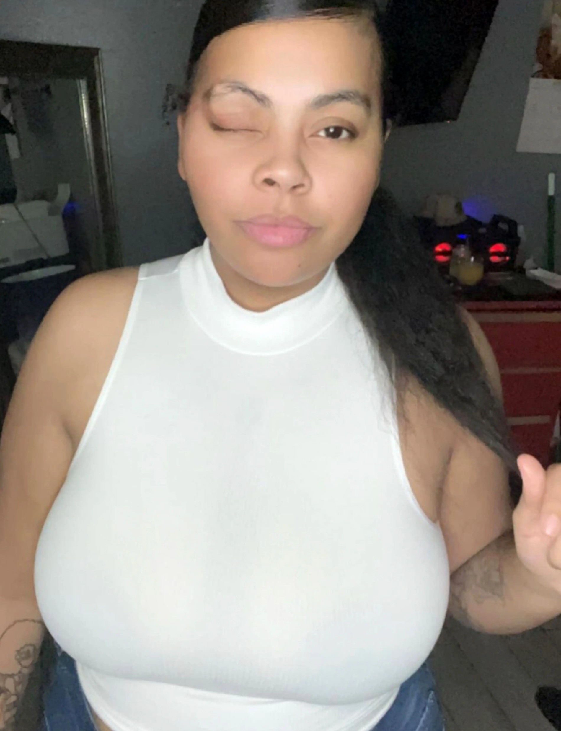 Джордан Лопес после удаления новообразования
Фото: ТикТок @girlwiththemark/ CATERS NEWS