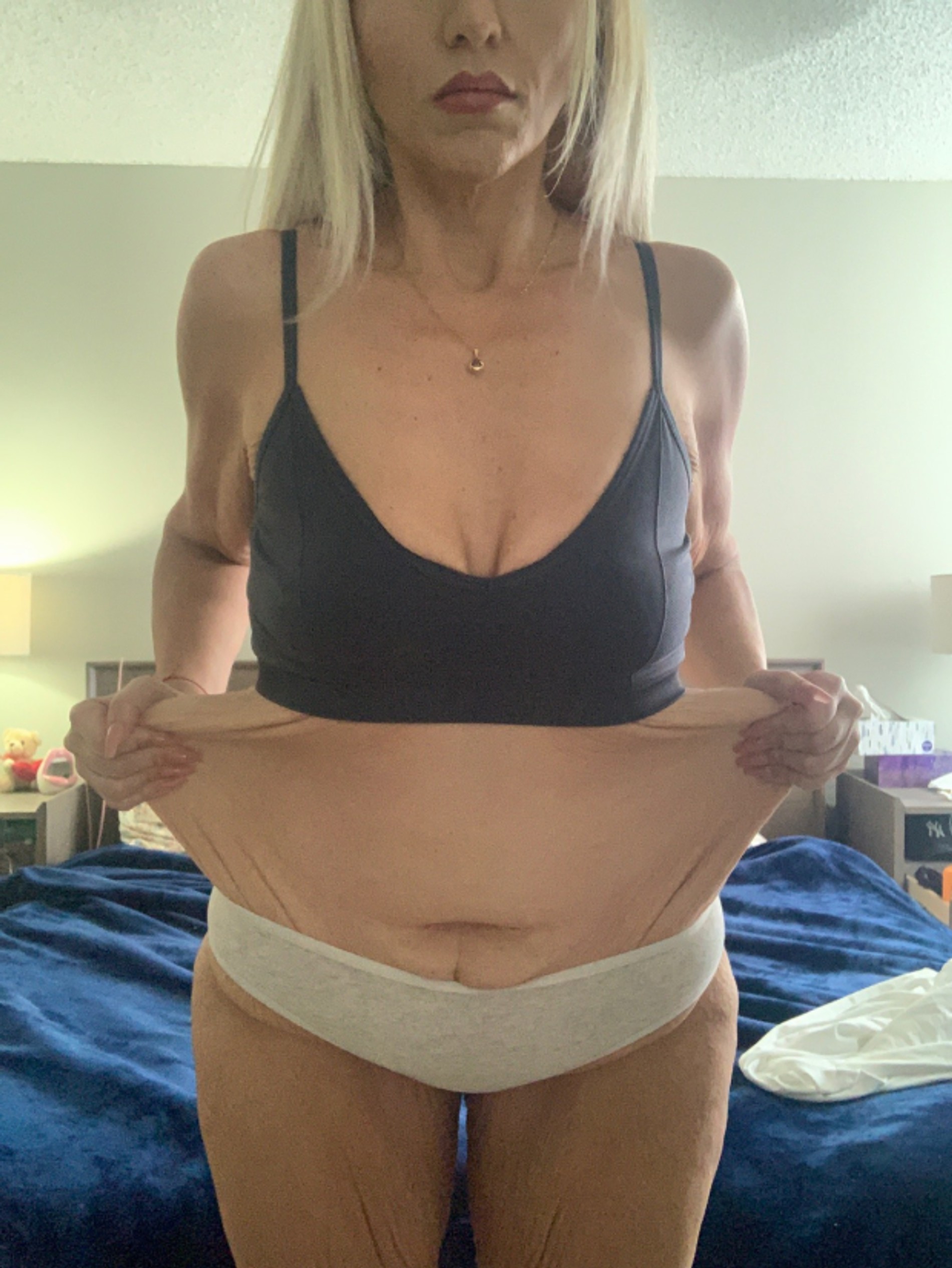 Стефани после похудения
Фото: The Sun