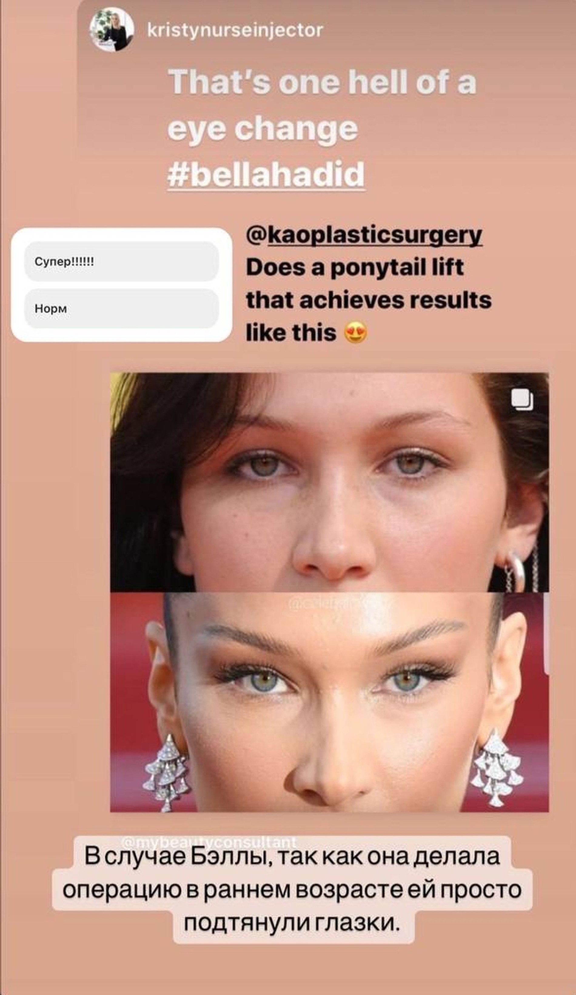 Фото: Инстаграм (запрещен в РФ) / @victoriabonya