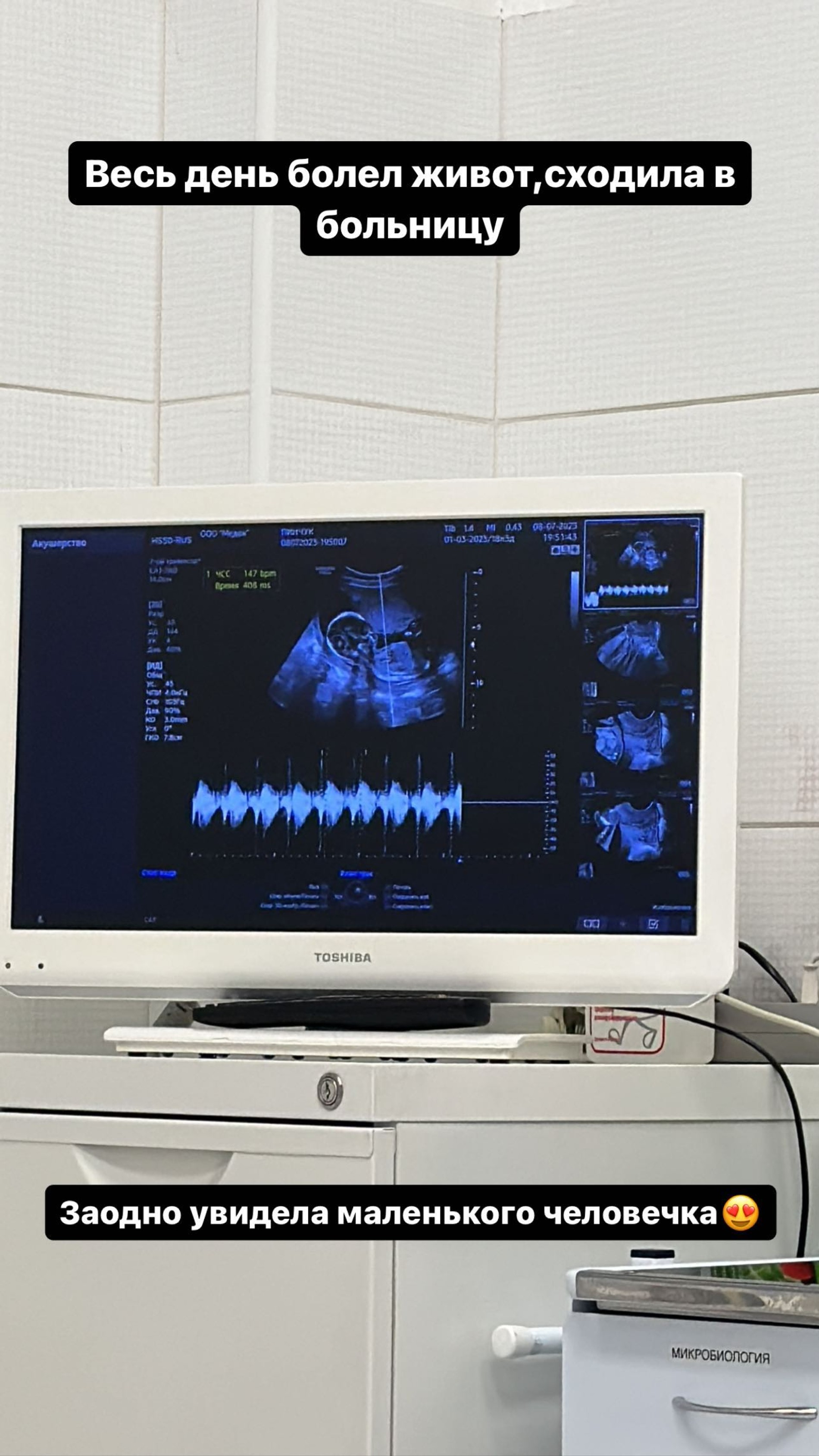 Ирина Пинчук поделилась с подписчиками самым ценным — УЗИ своего ребенка. Фото: Инстаграм (запрещен в РФ) @pinchuk_official
