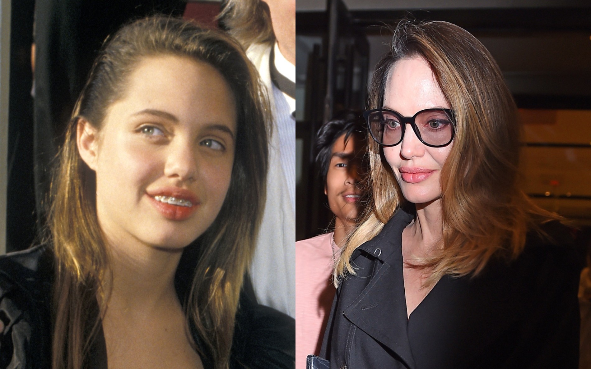 Фото: Getty Images