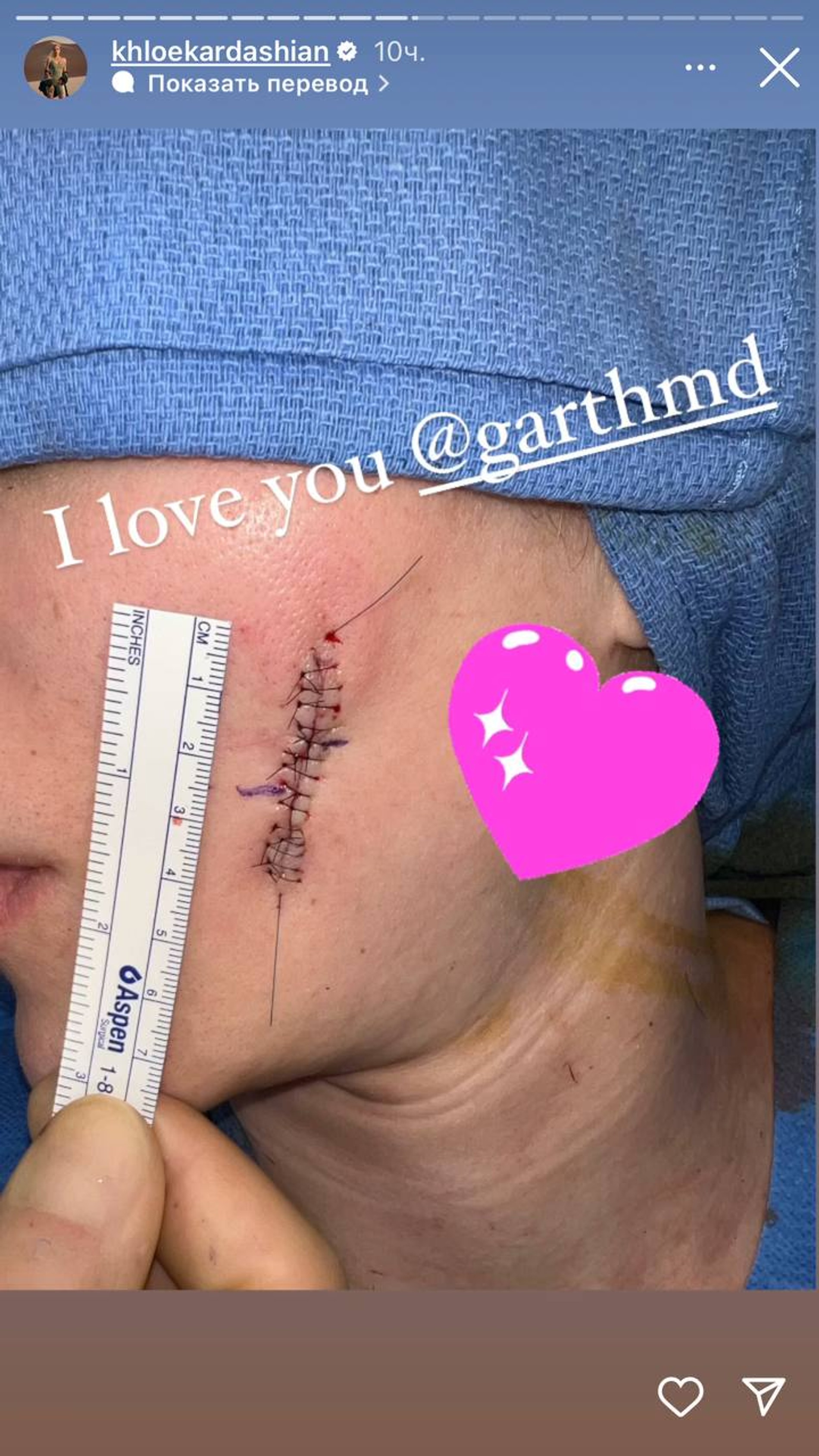 Фото: Инстаграм* @khloekardashian