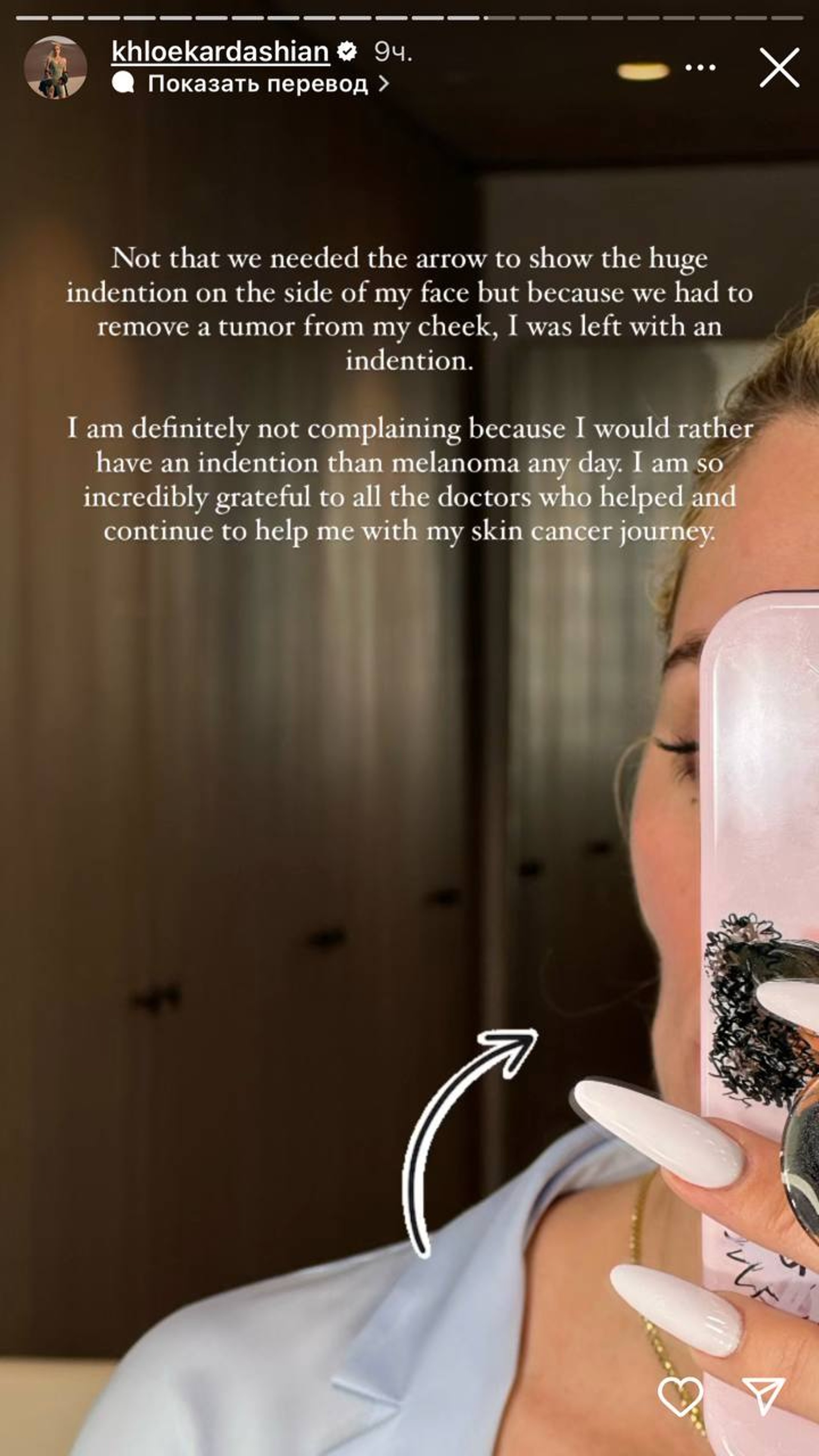 Фото: Инстаграм* @khloekardashian