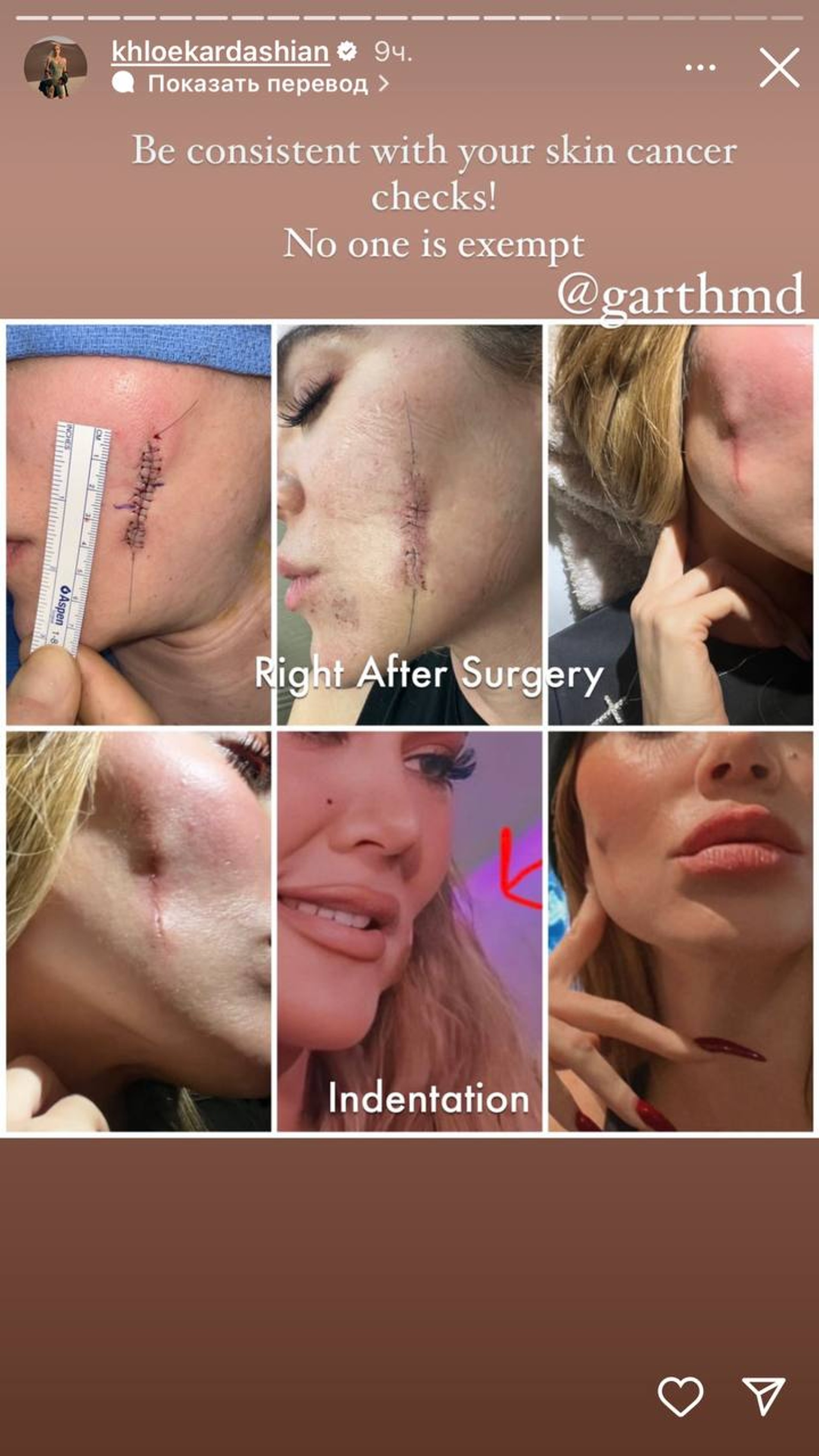 Фото: Инстаграм* @khloekardashian