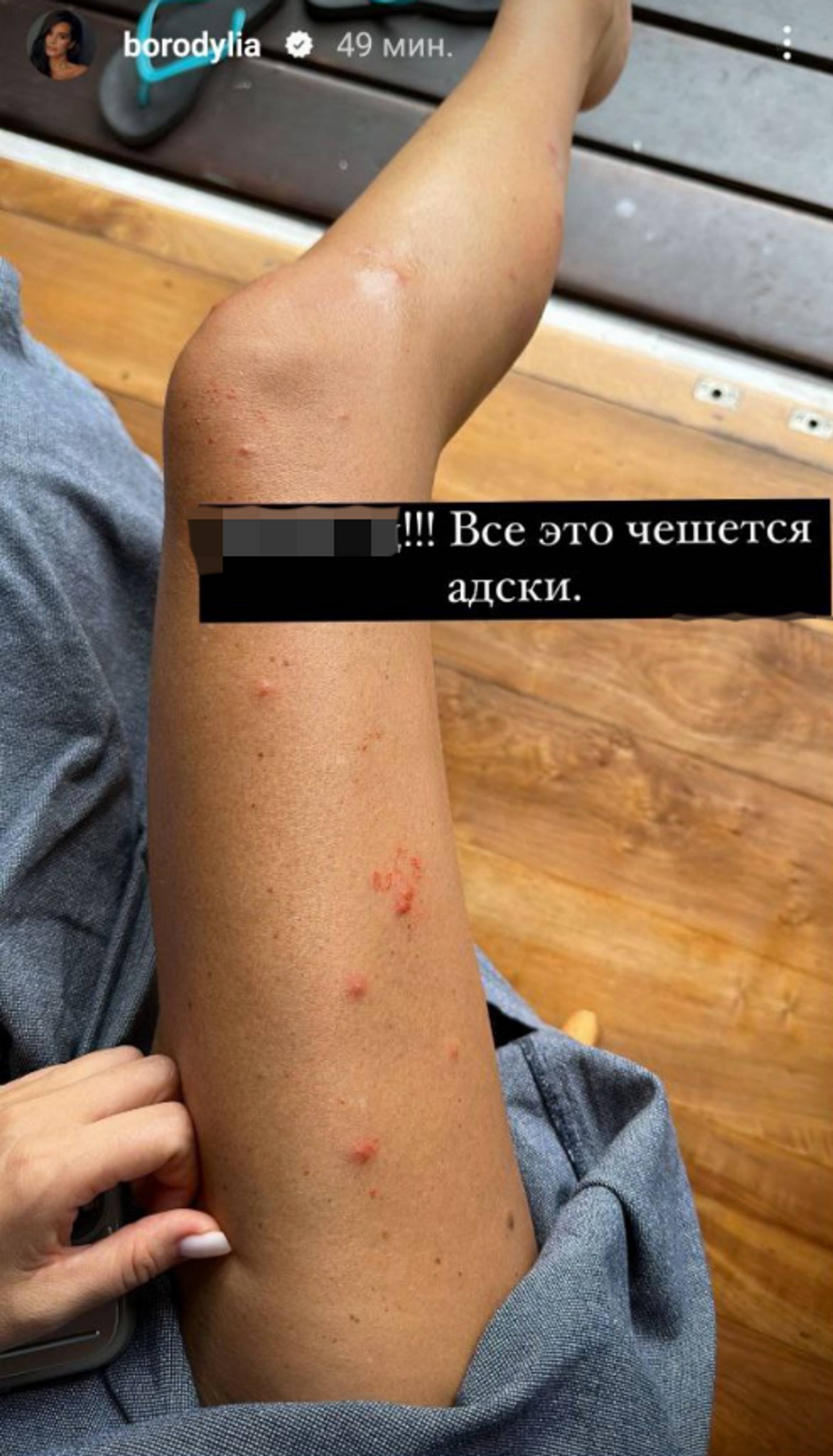 Фото: Инстаграм (запрещен в РФ) @borodylia