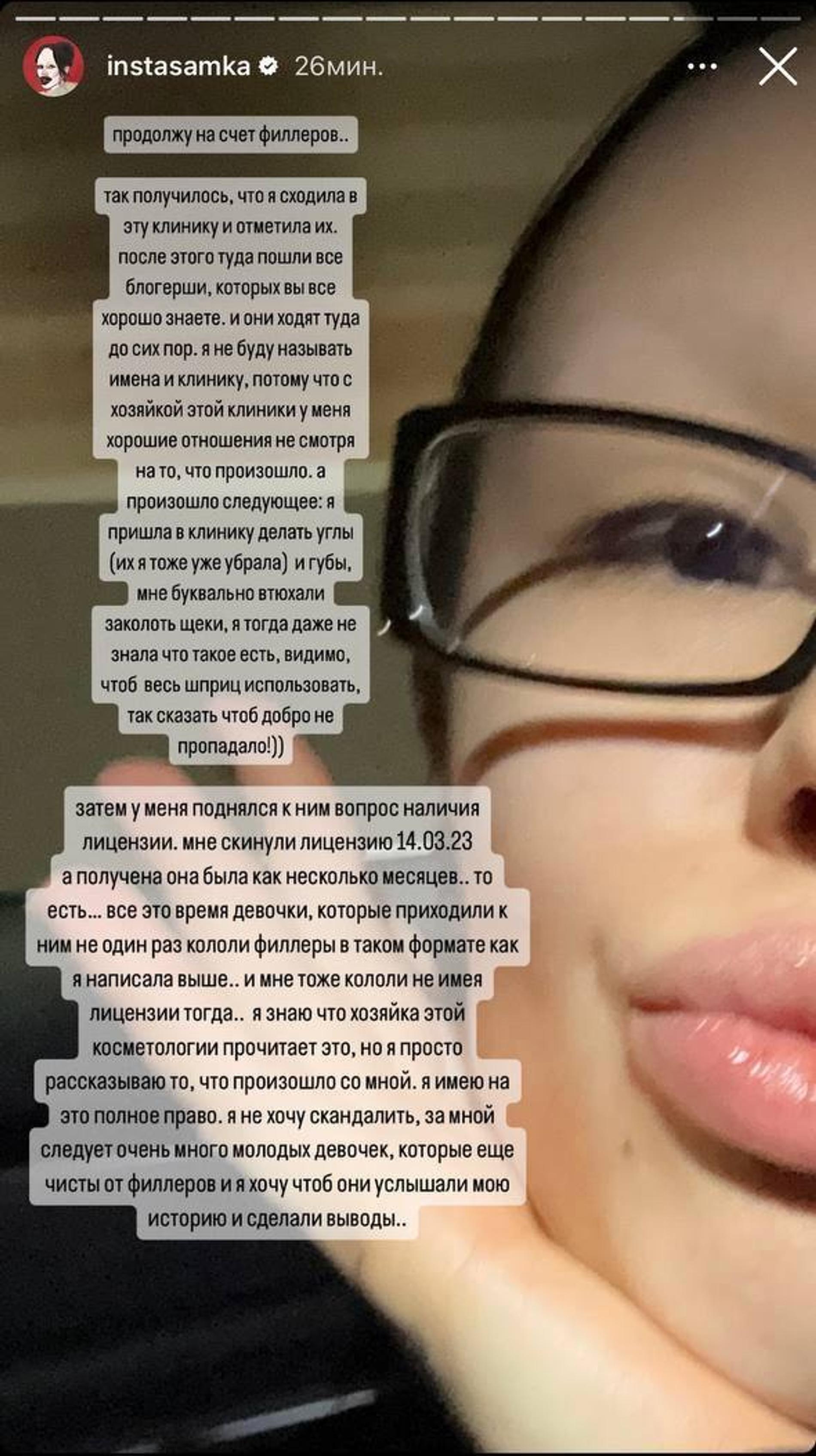 Инстасамка. Фото: Инстаграм* @instasamka