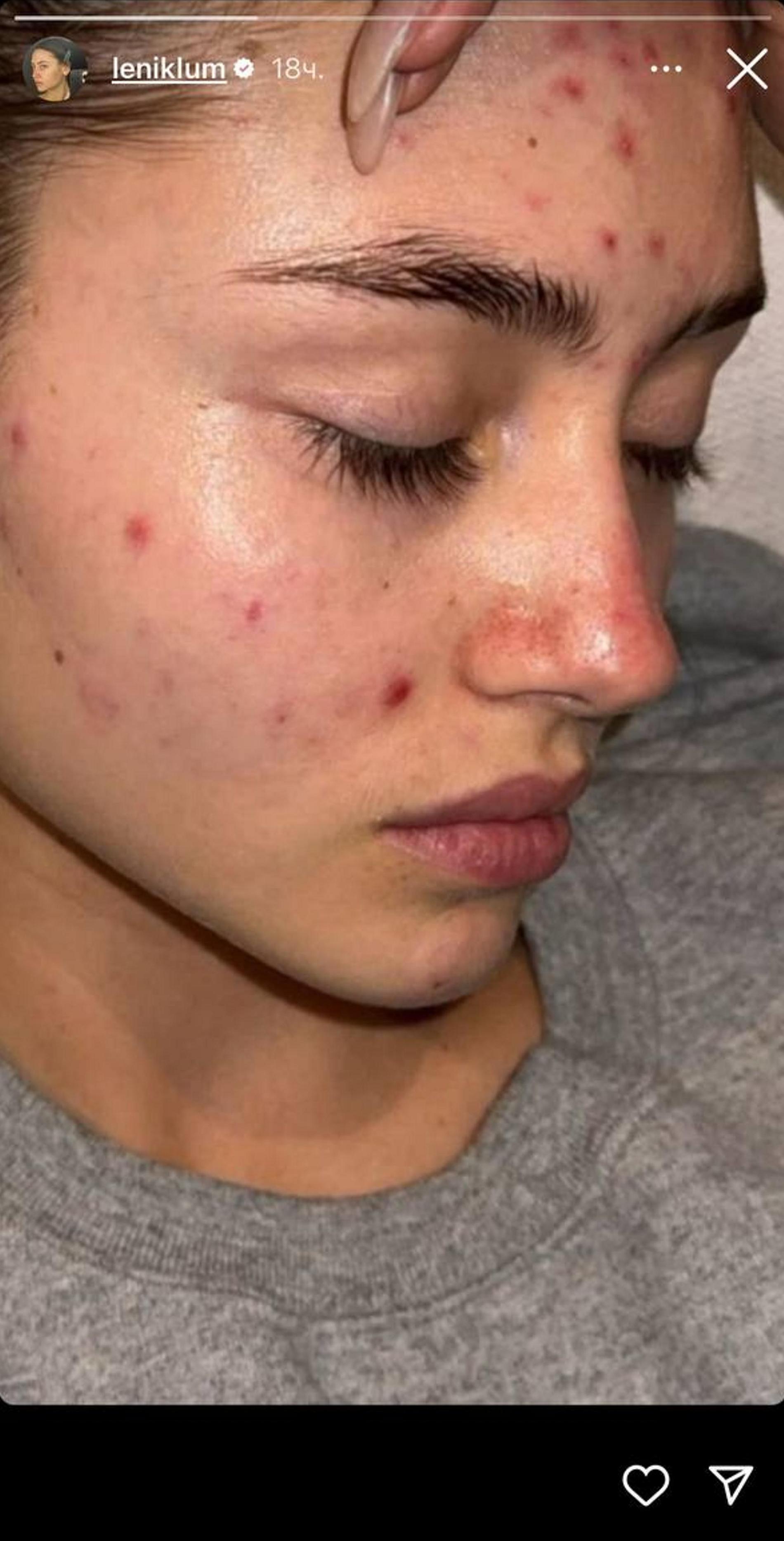 Лени Клум. Фото: Инстаграм* @leniklum