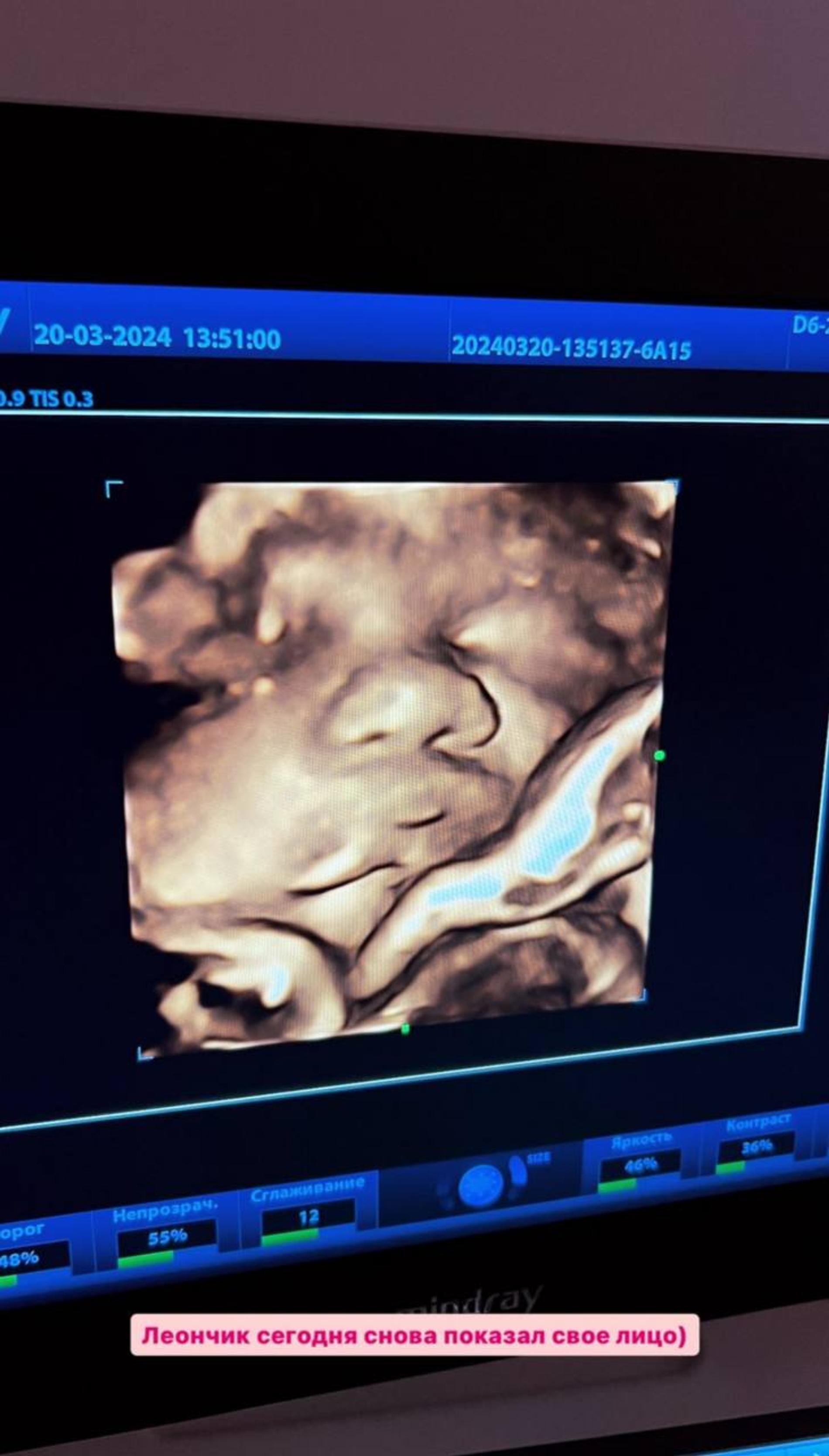 Тигран Салибеков показал сына. Фото: Инстаграм* @tigran_salibekov