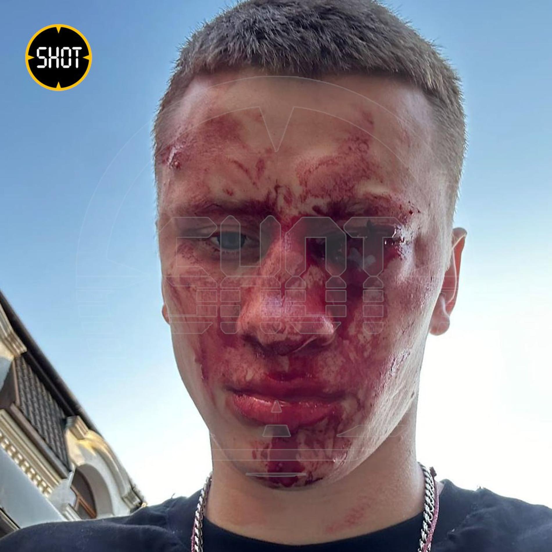 Фото: телеграм-канал Shot