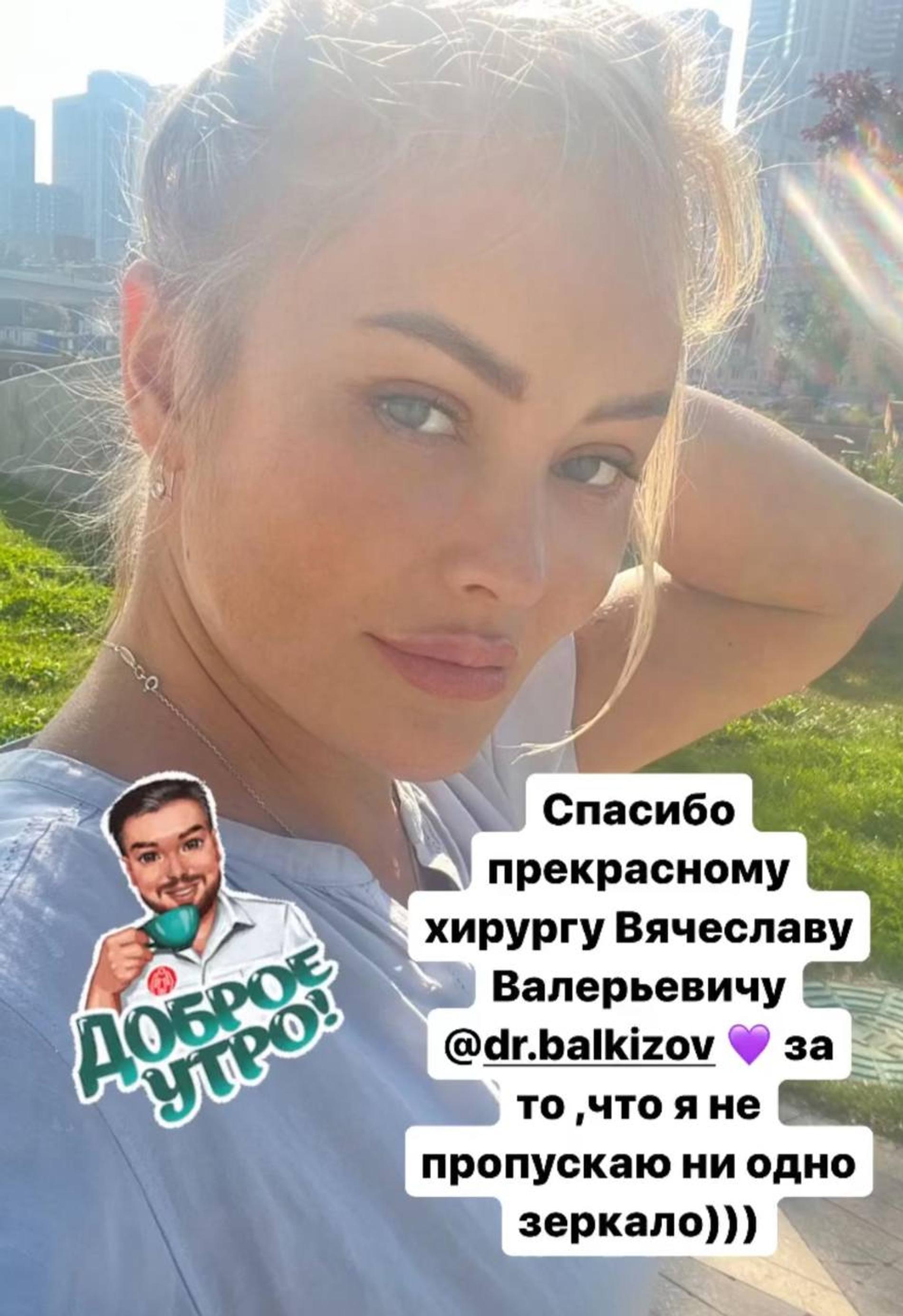 Дана Борисова после пластической операции. Фото: Инстаграм* @danaborisova_official