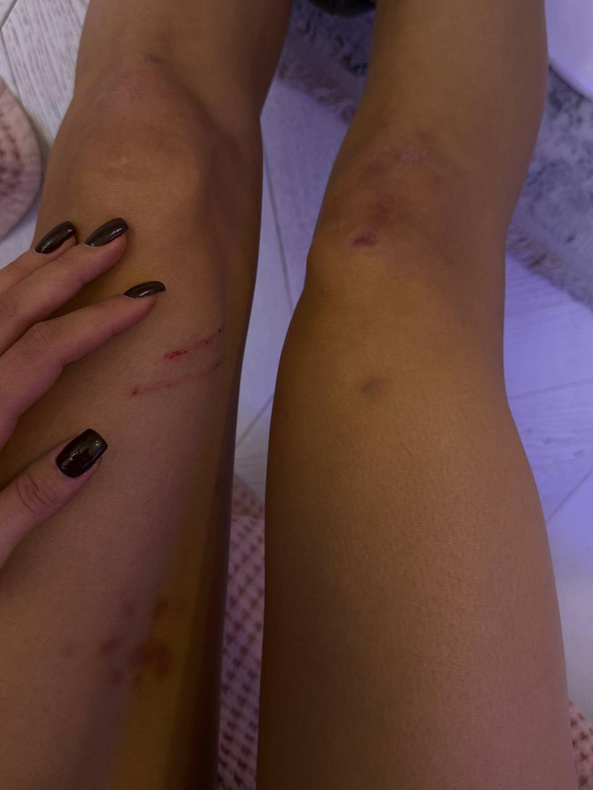 Фото: Telegram @karnava1l