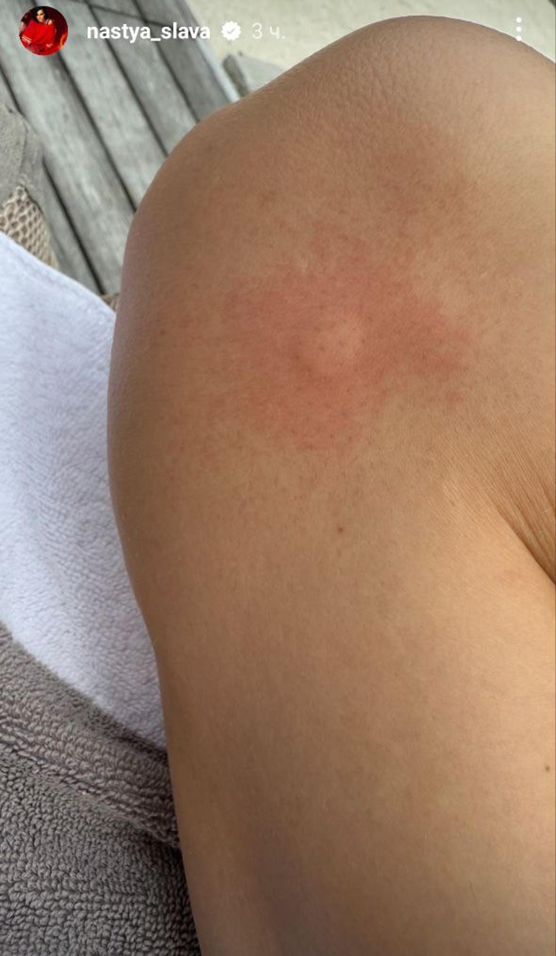 Скриншот: Инстаграм (запрещен в РФ) @sasha.morozovaaa