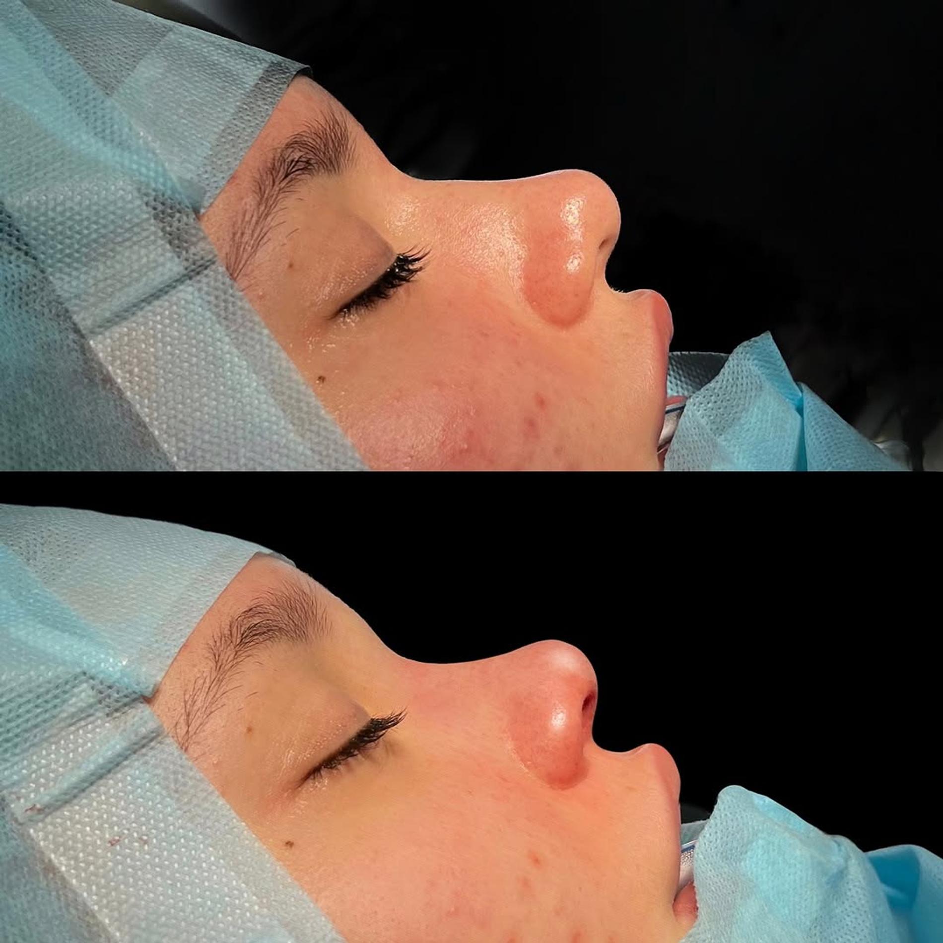 Фото: Инстаграм (запрещен в РФ) @babayanplastic