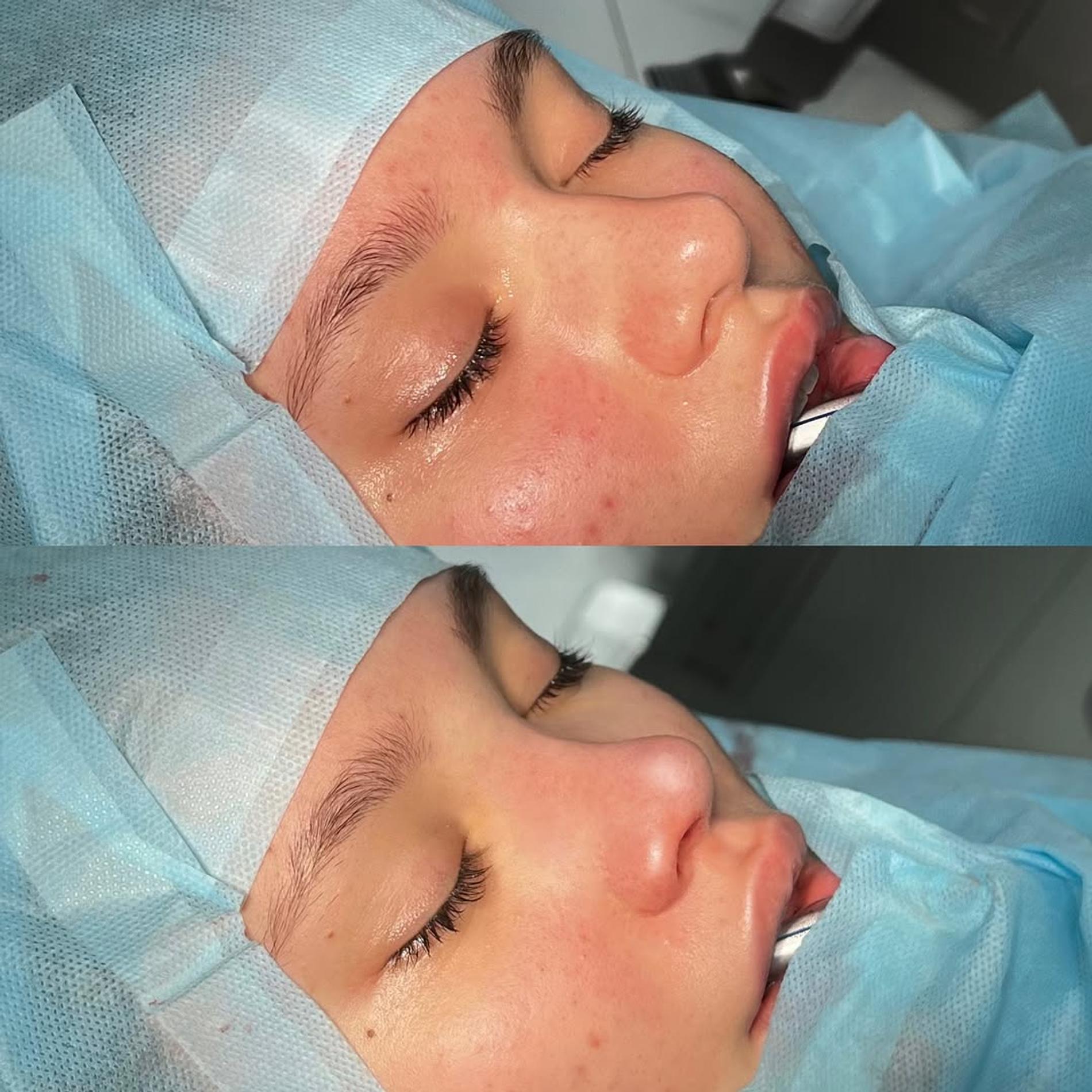 Фото: Инстаграм (запрещен в РФ) @babayanplastic