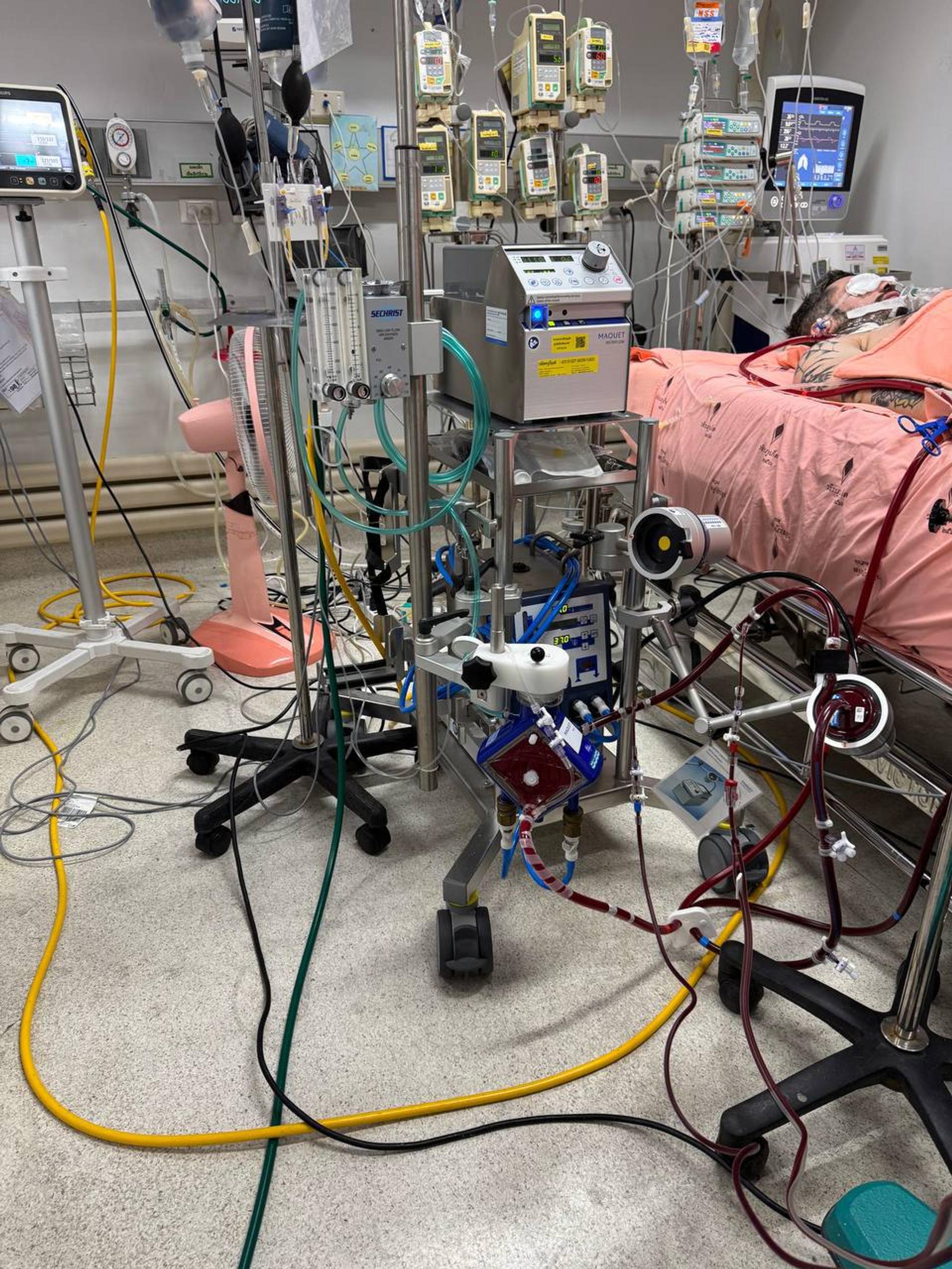 Паша Техник находится в коме в госпитале Таиланда. Фото: Telegram-канал «Выжившие»