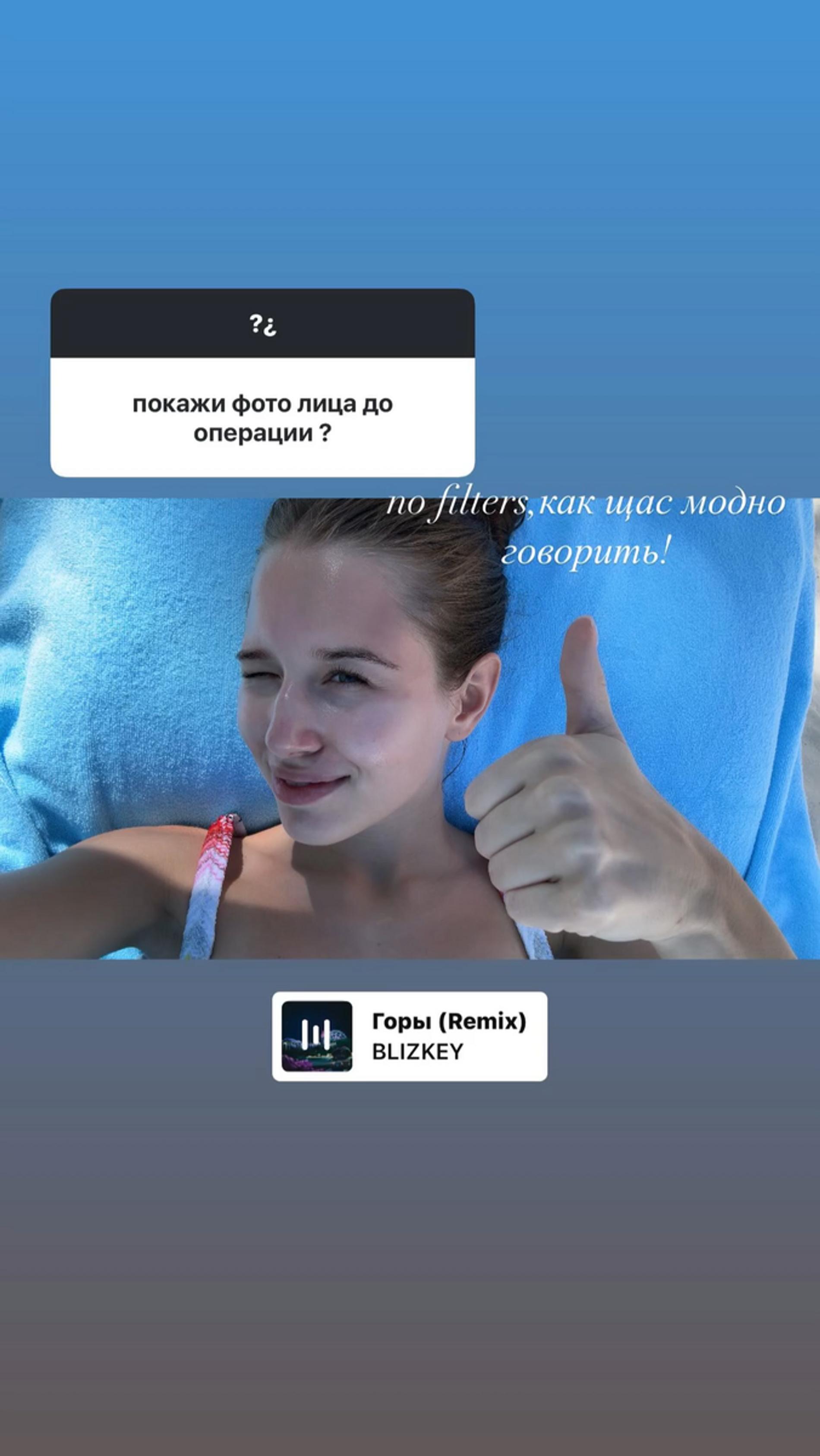 Скрин: Инстаграм (запрещён в РФ) @avrorakiba