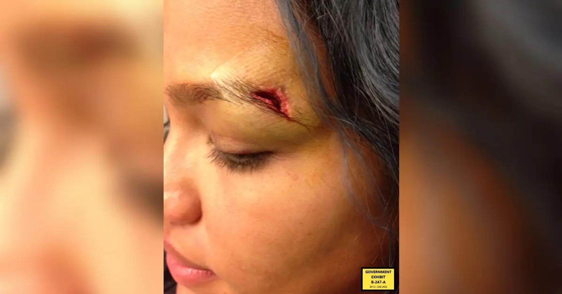 Кэсси Вентура после избиения P. Diddy. Фото: RadarOnline