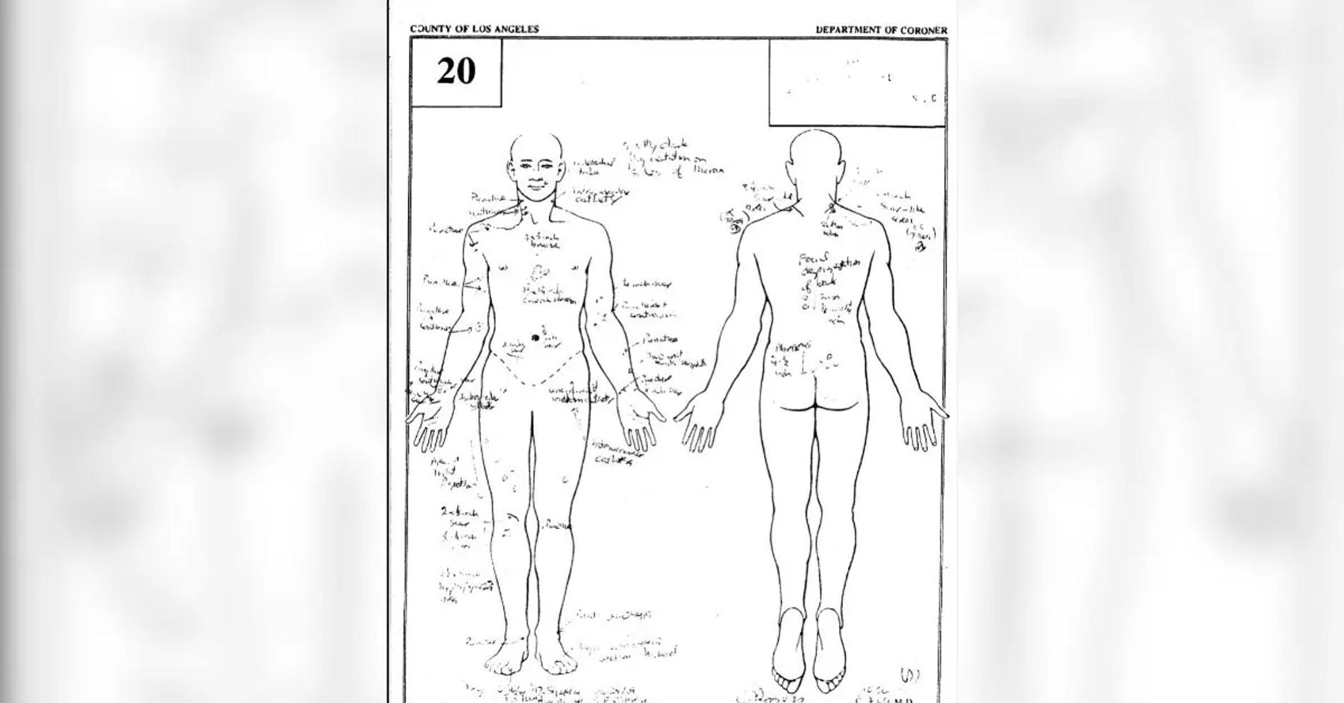 Фото: COUNTY OF LOS ANGELES CORONER