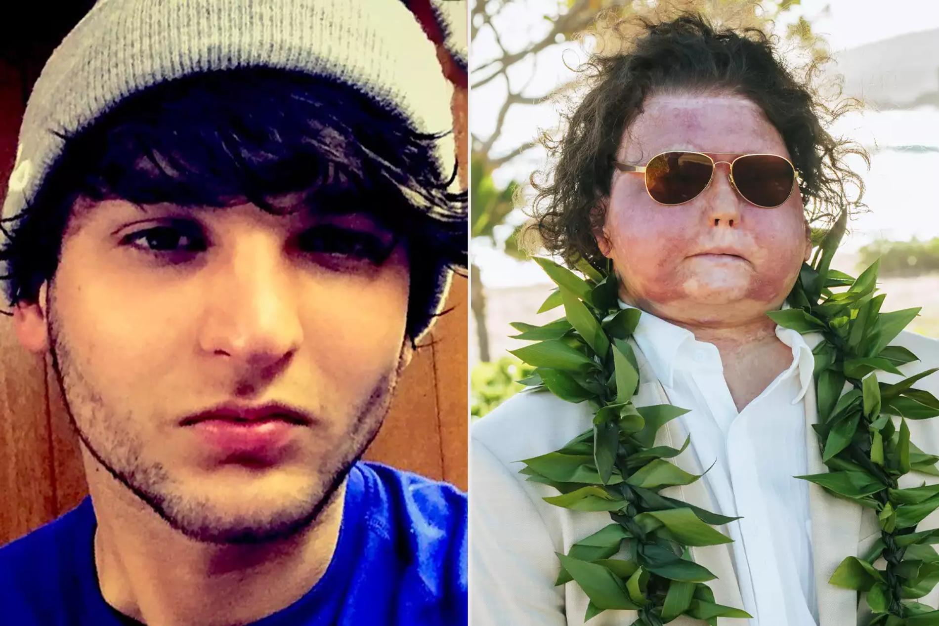 Джо Димео до аварии и сейчас. Фото: People