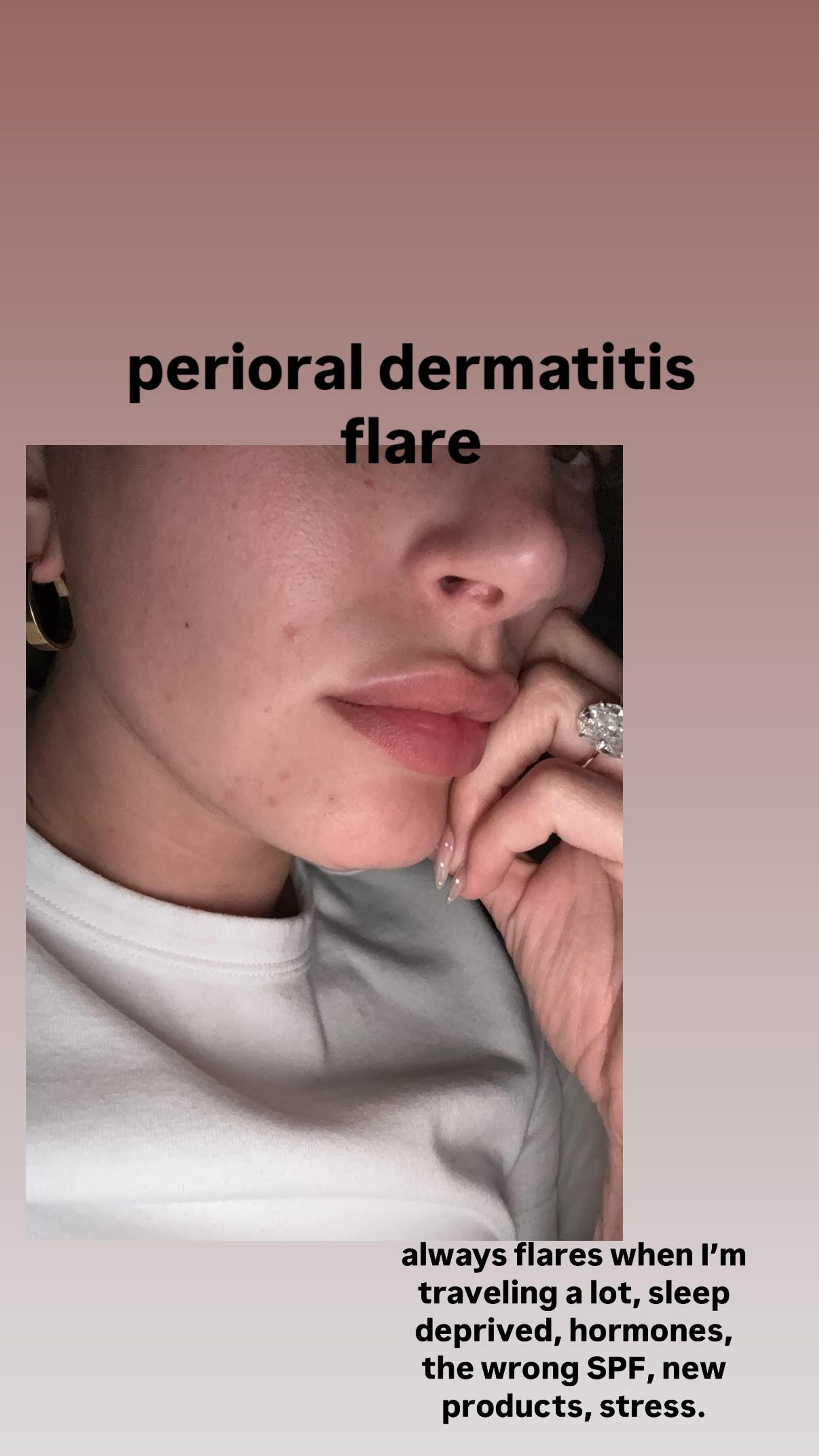 Фото: Инстаграм (запрещён в РФ) @haileybieber