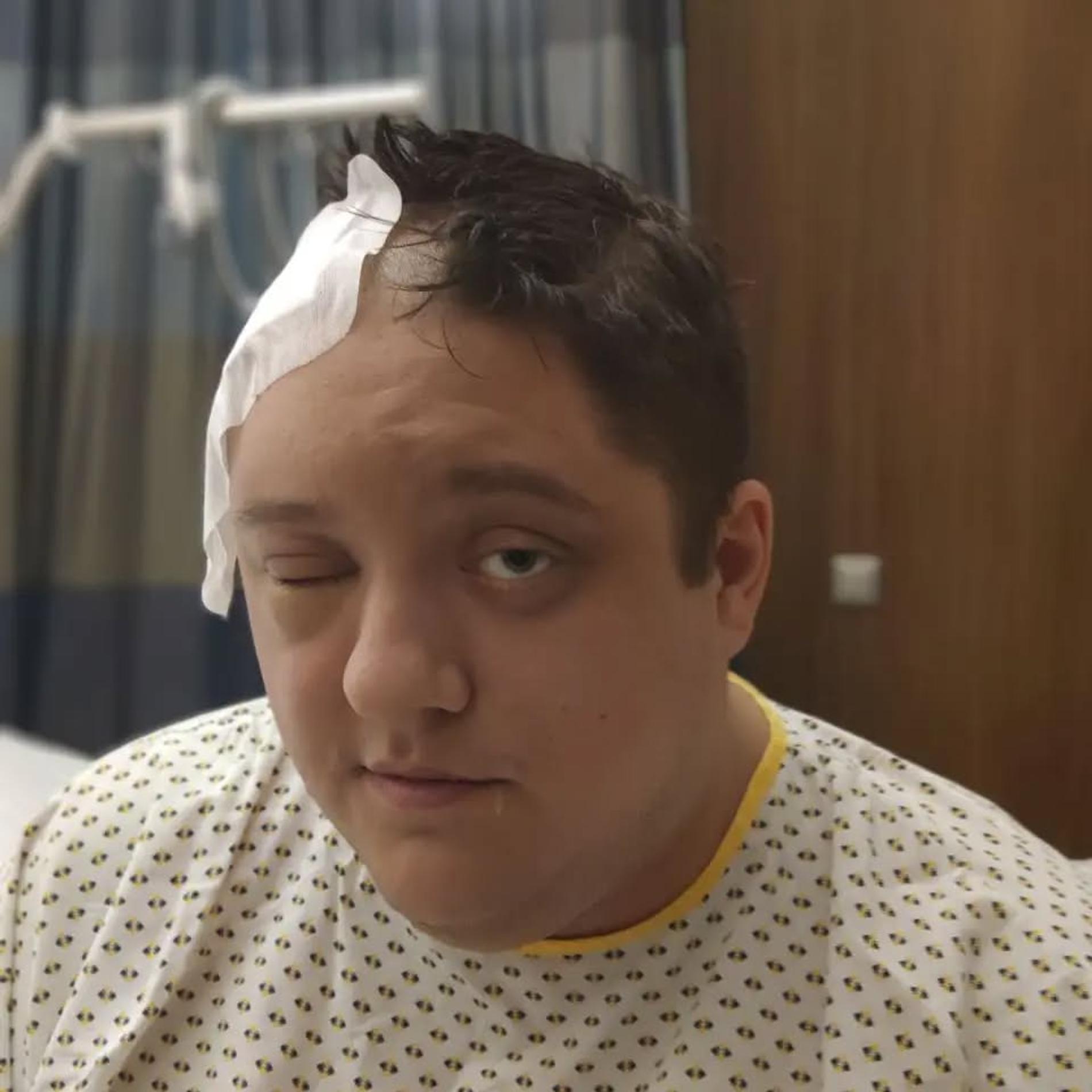 Роман Попов после операции, 2018 год. Фото: Инстаграм (запрещен в РФ) @romapopoff